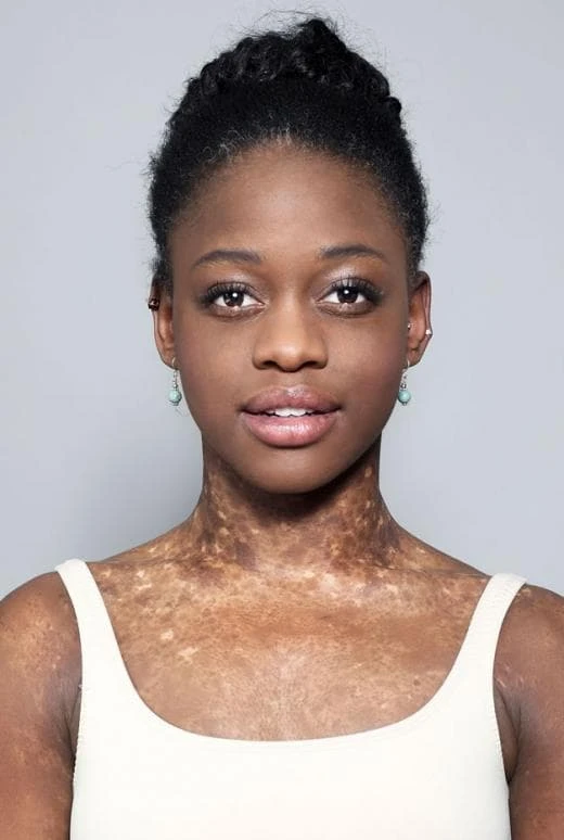 Foto von Michaela Deprince