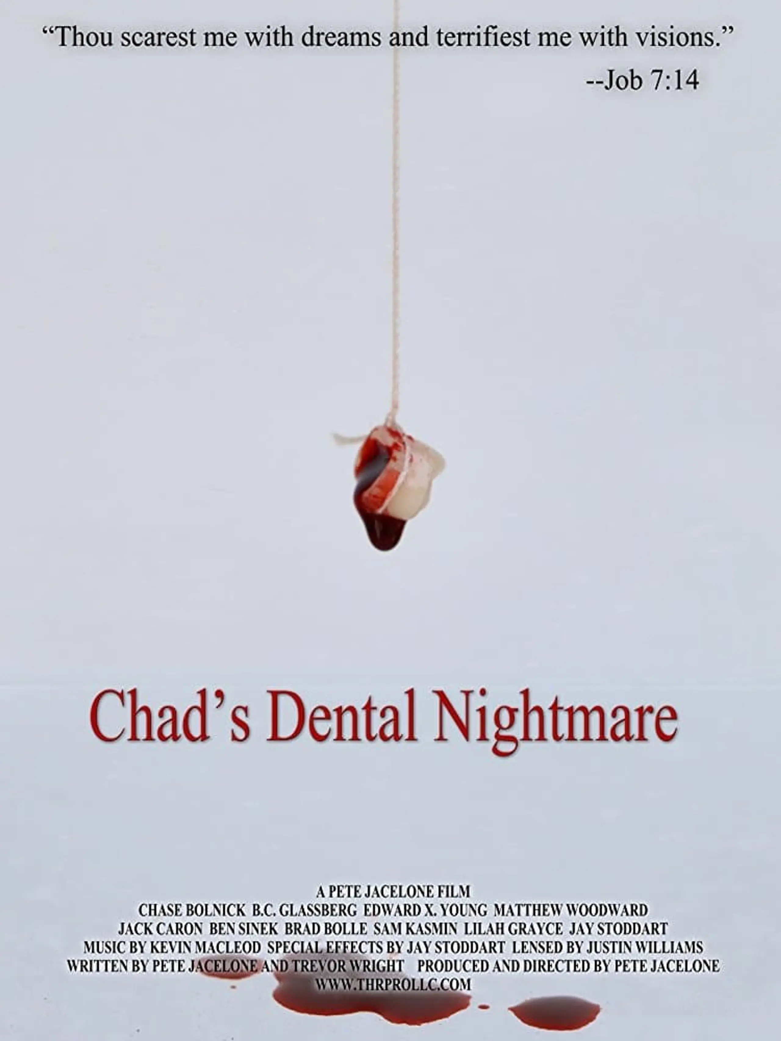 Chad's Dental Nightmare