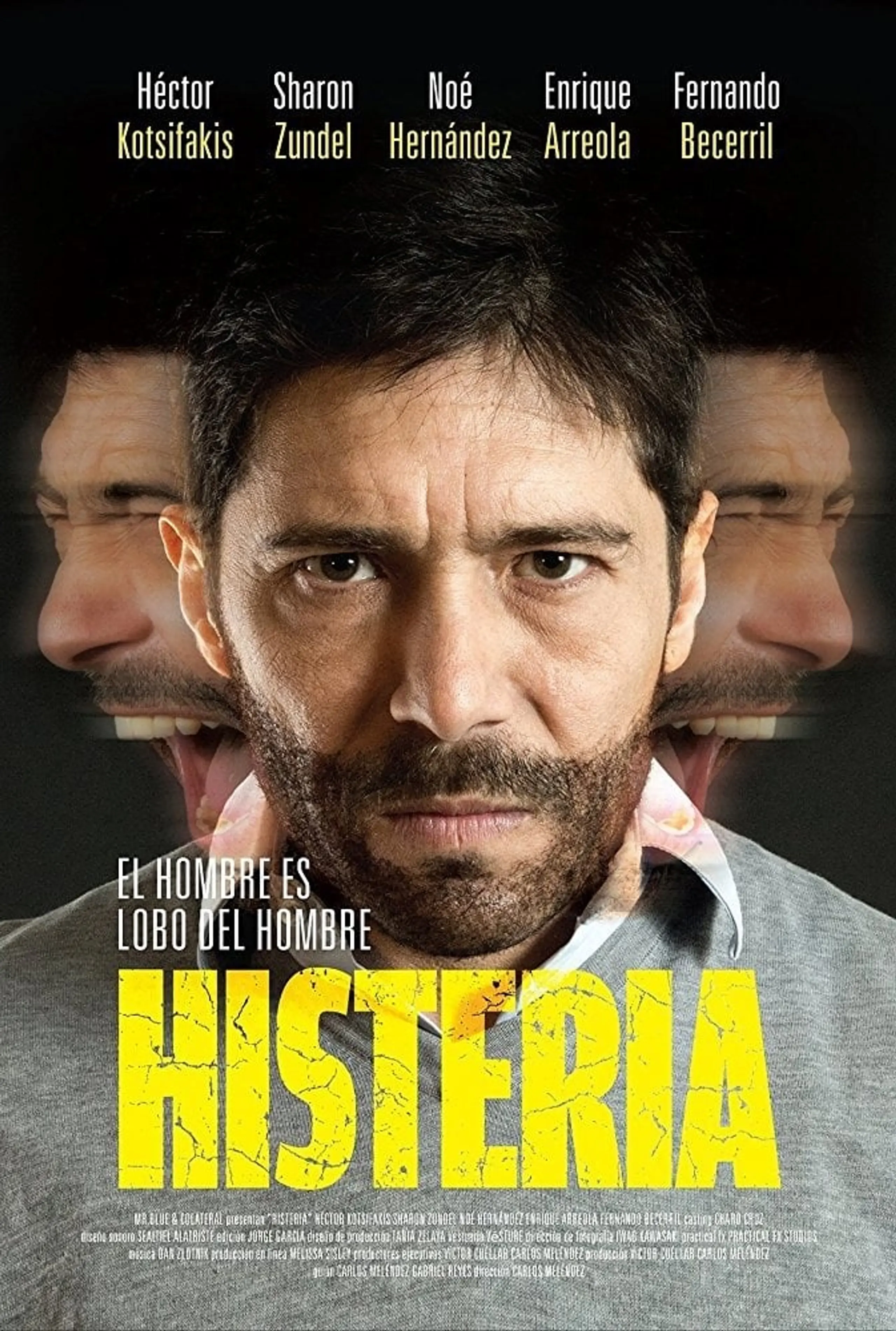 Histeria