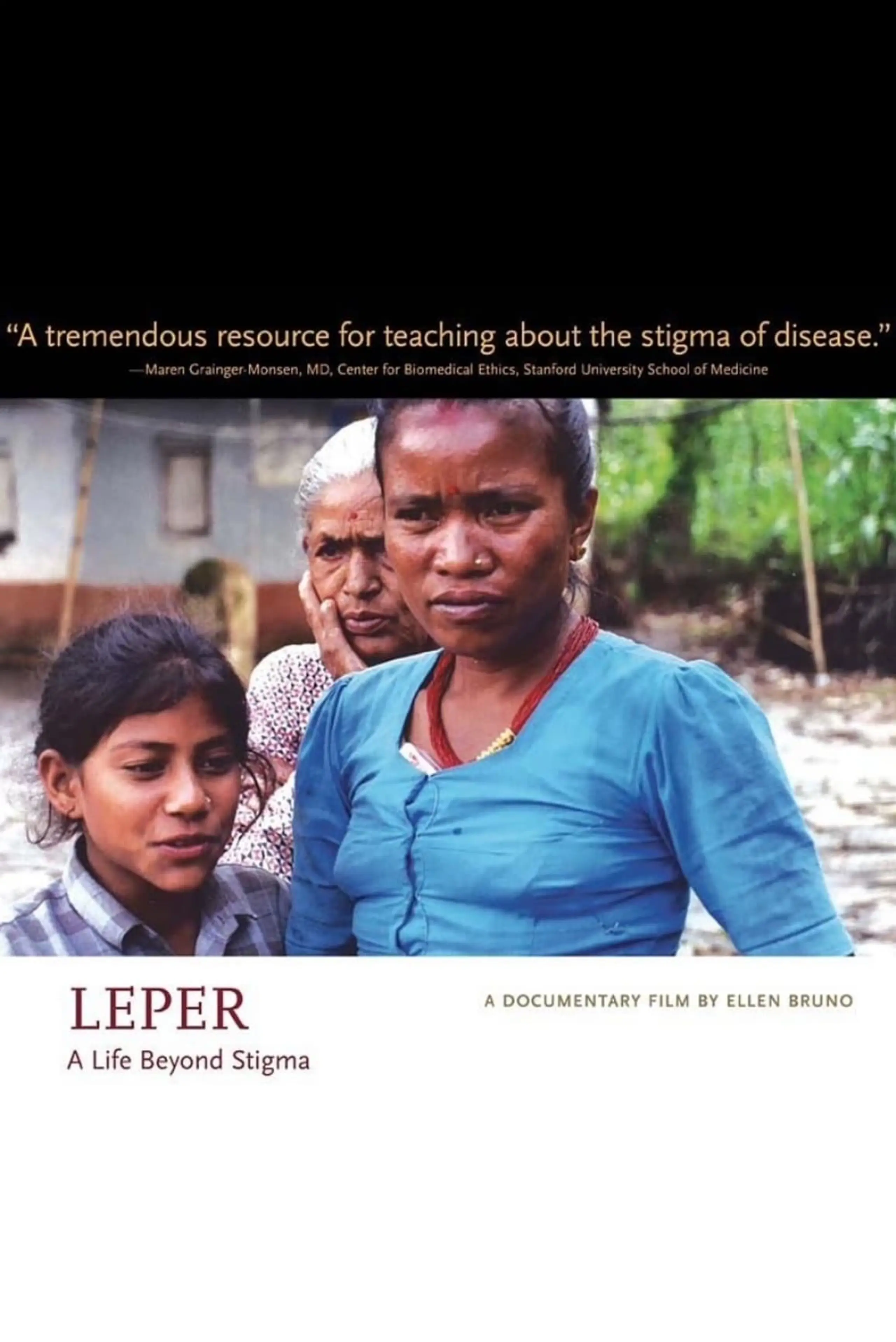 Leper Life Beyond Stigma