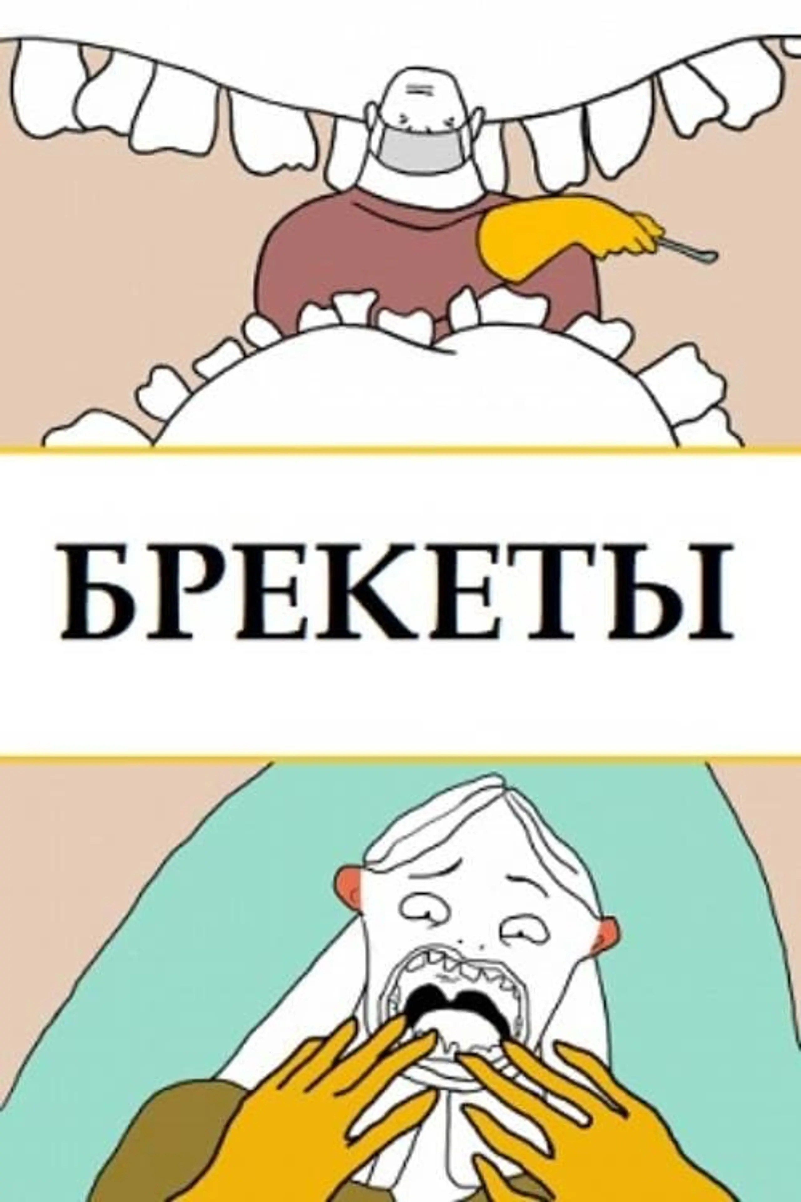 Брекеты