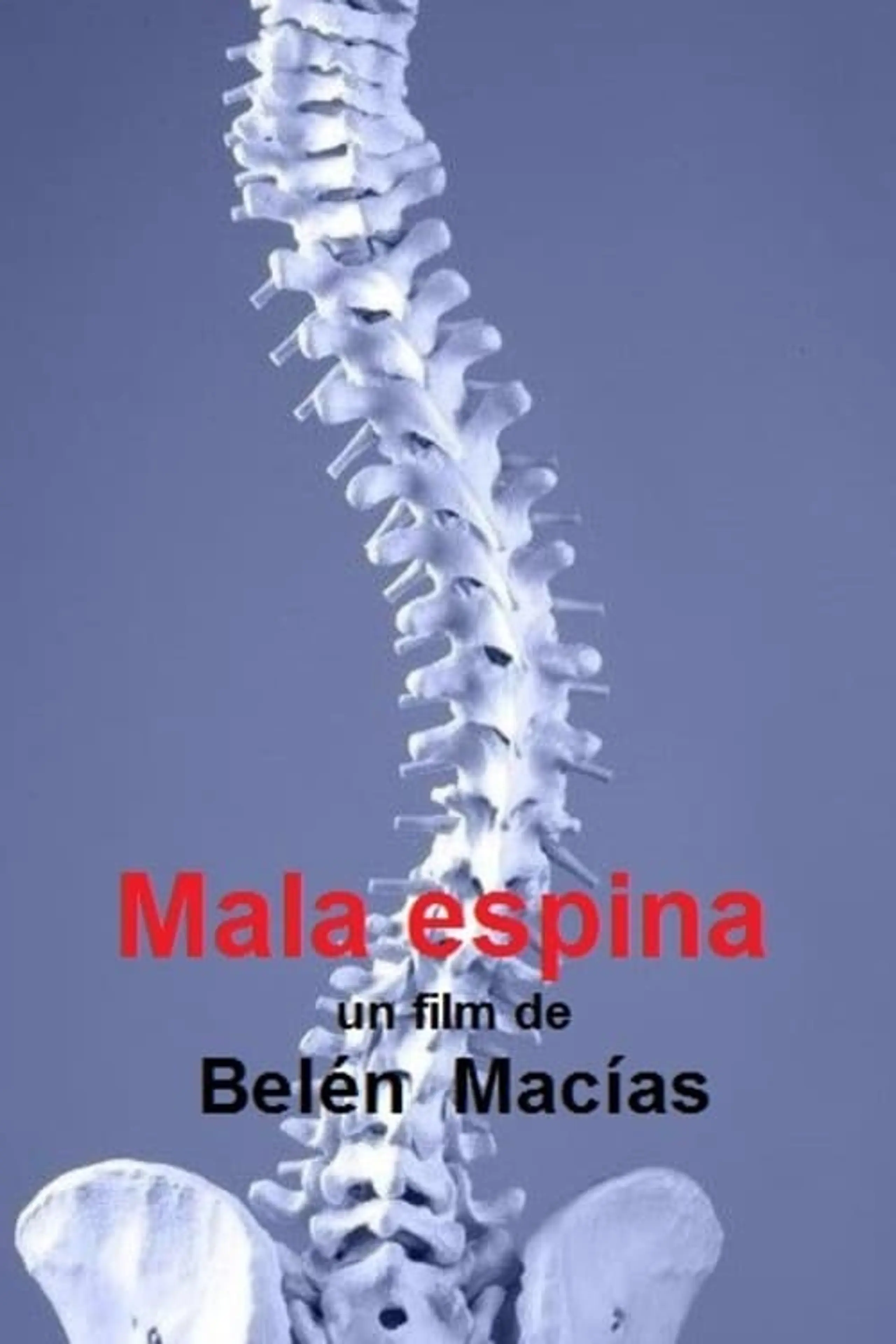 Mala Espina