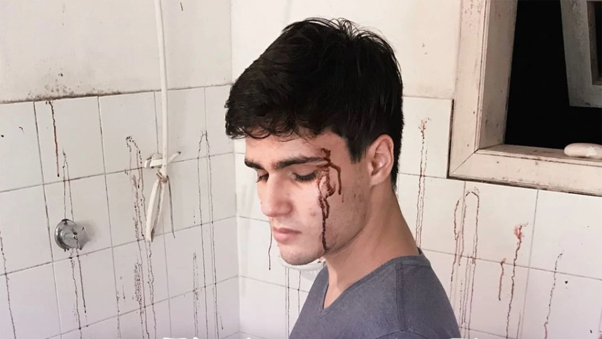 Anteface