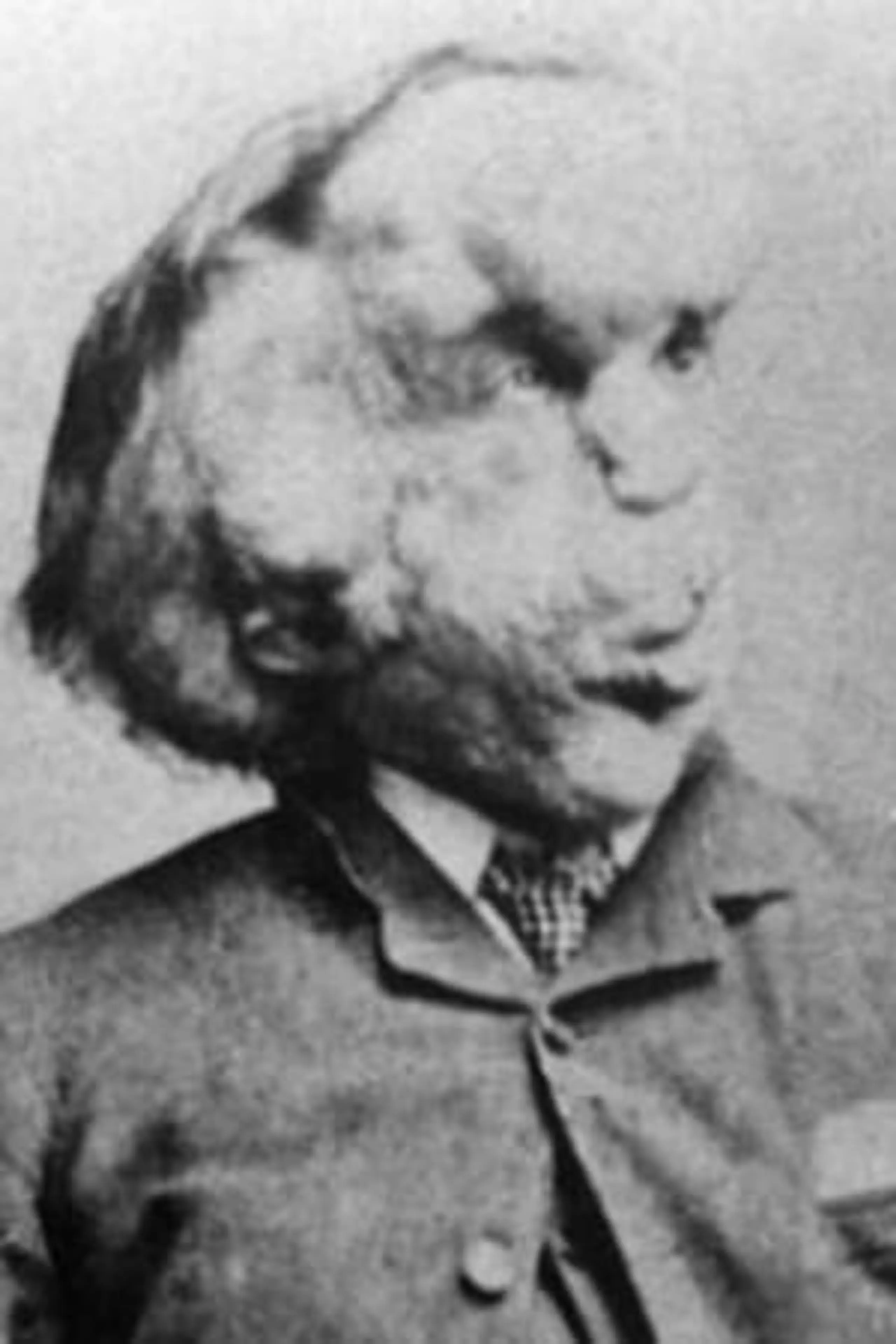 Foto von Joseph Merrick