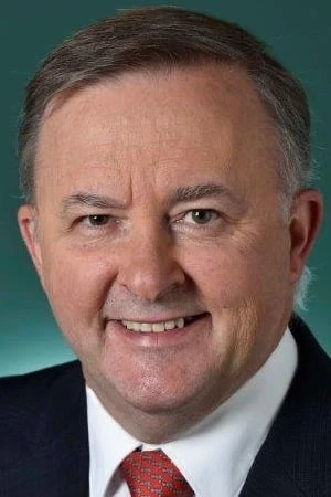 Foto von Anthony Albanese