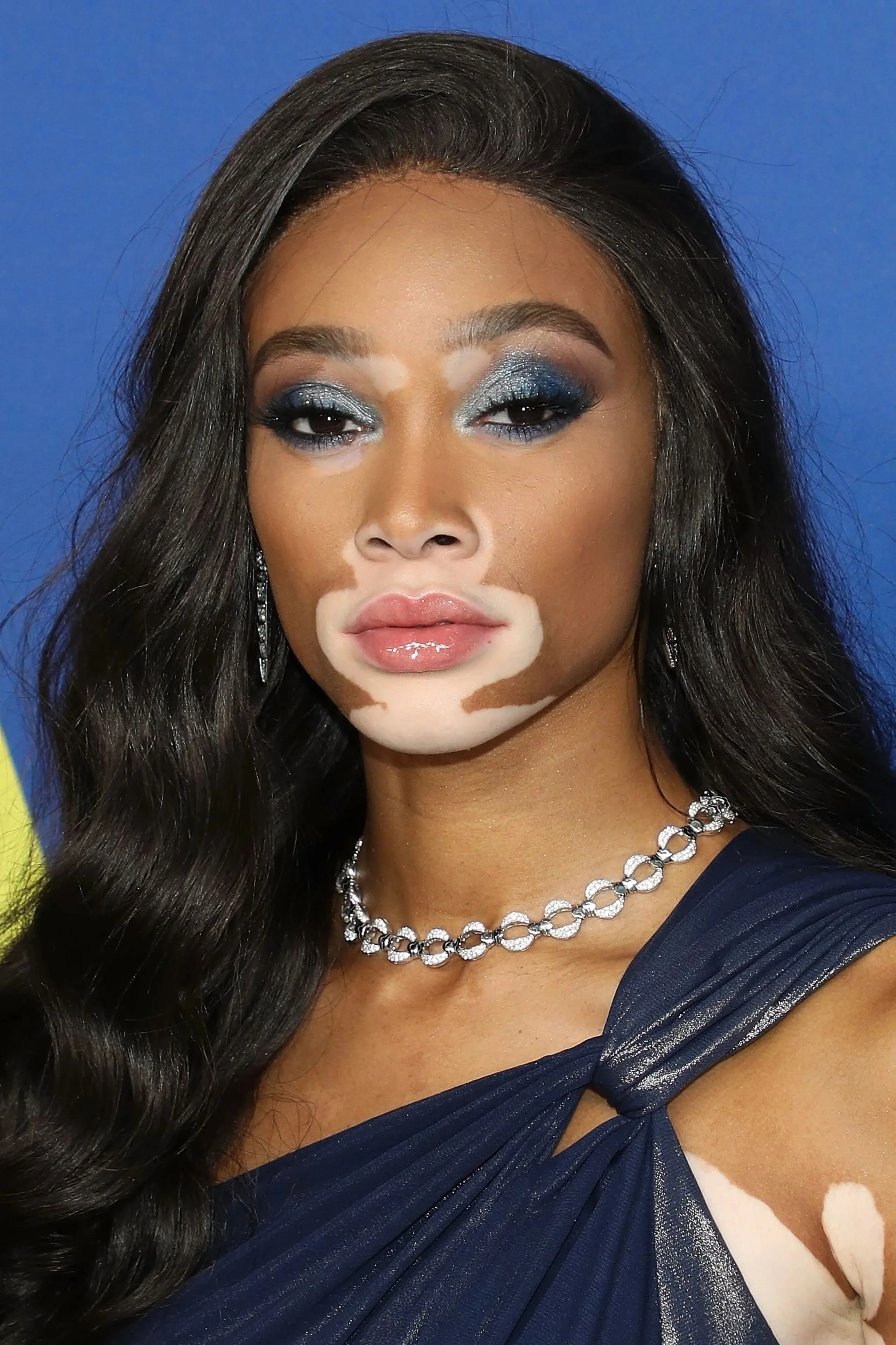 Foto von Winnie Harlow