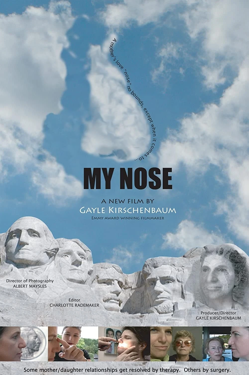 My Nose