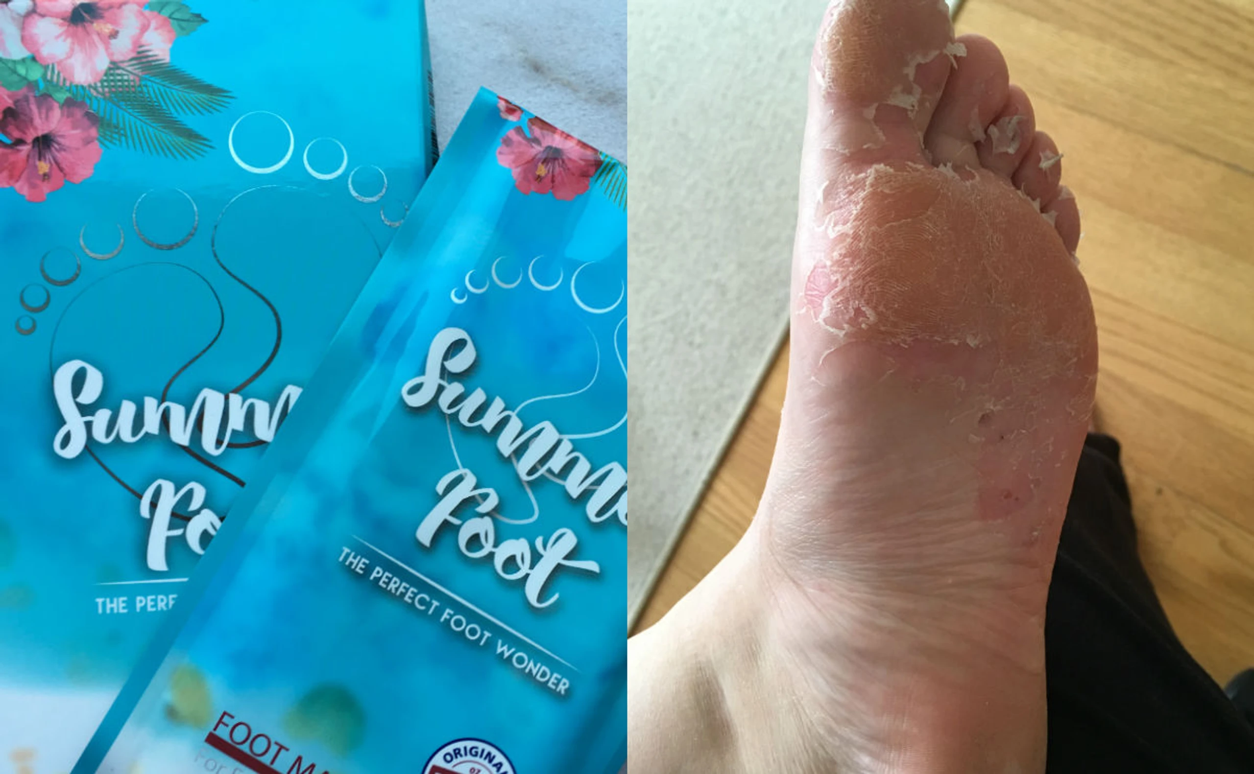 WOMAN testet: Fußmaske, durch die sich die Haut ablöst