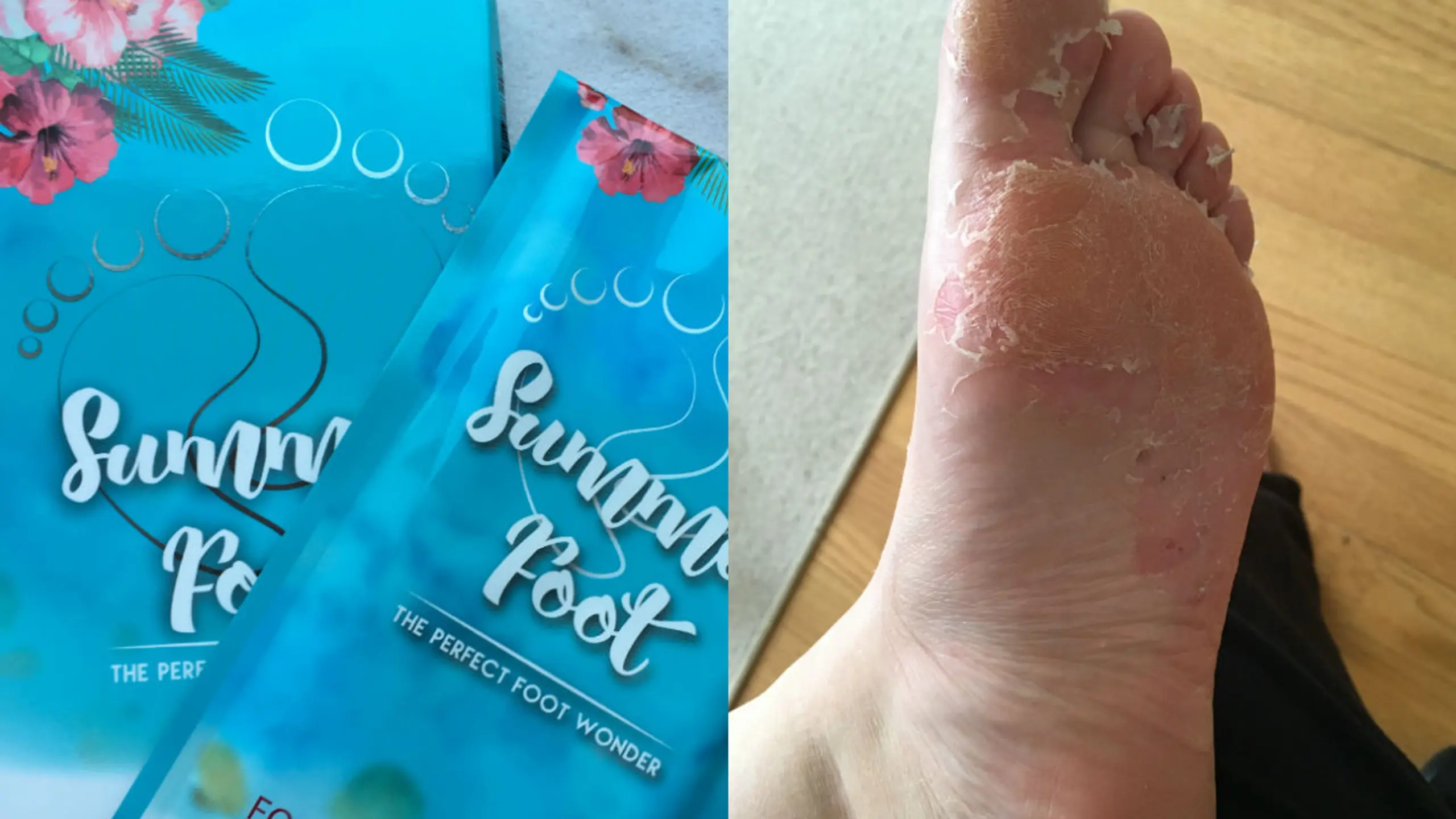WOMAN testet: Fußmaske, durch die sich die Haut ablöst