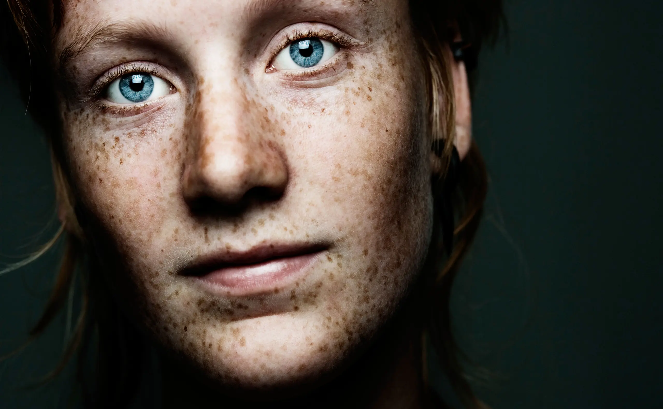 Pigmentflecken im Gesicht: So wurde ich sie (beinahe) los!
