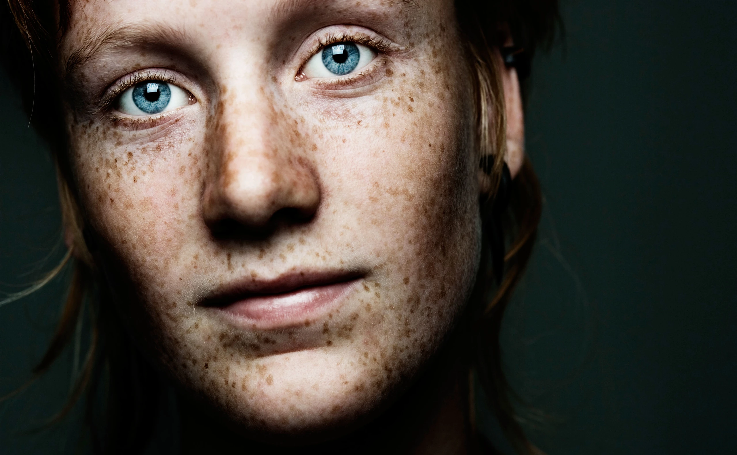 Pigmentflecken im Gesicht: So wurde ich sie (beinahe) los!