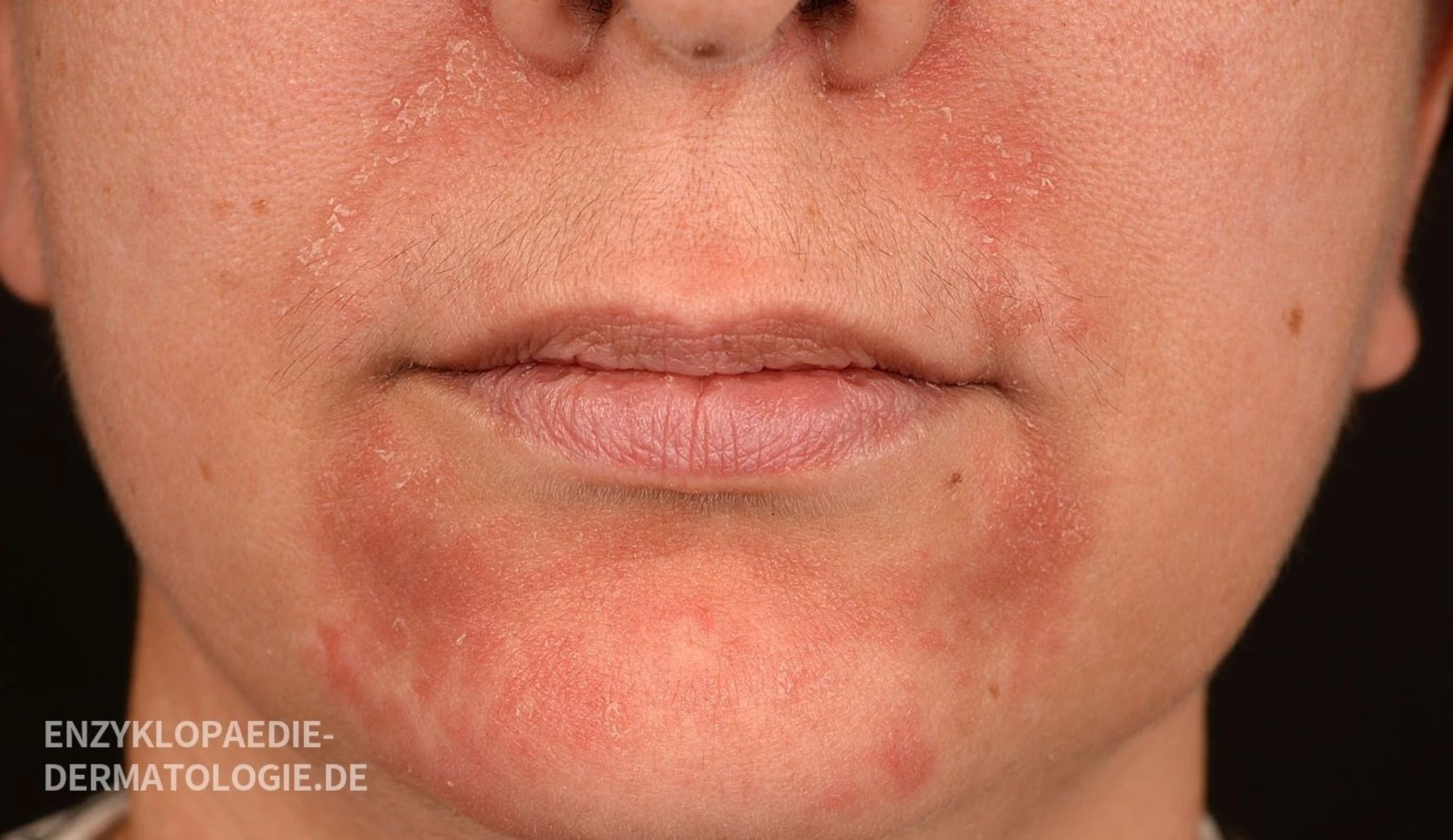 Blurred image background