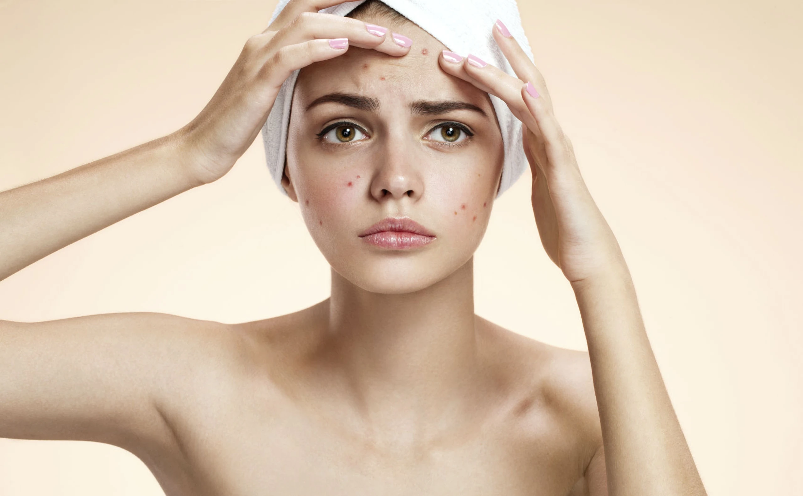 Diese Maske zum Selbermachen entfernt ALLE Mitesser