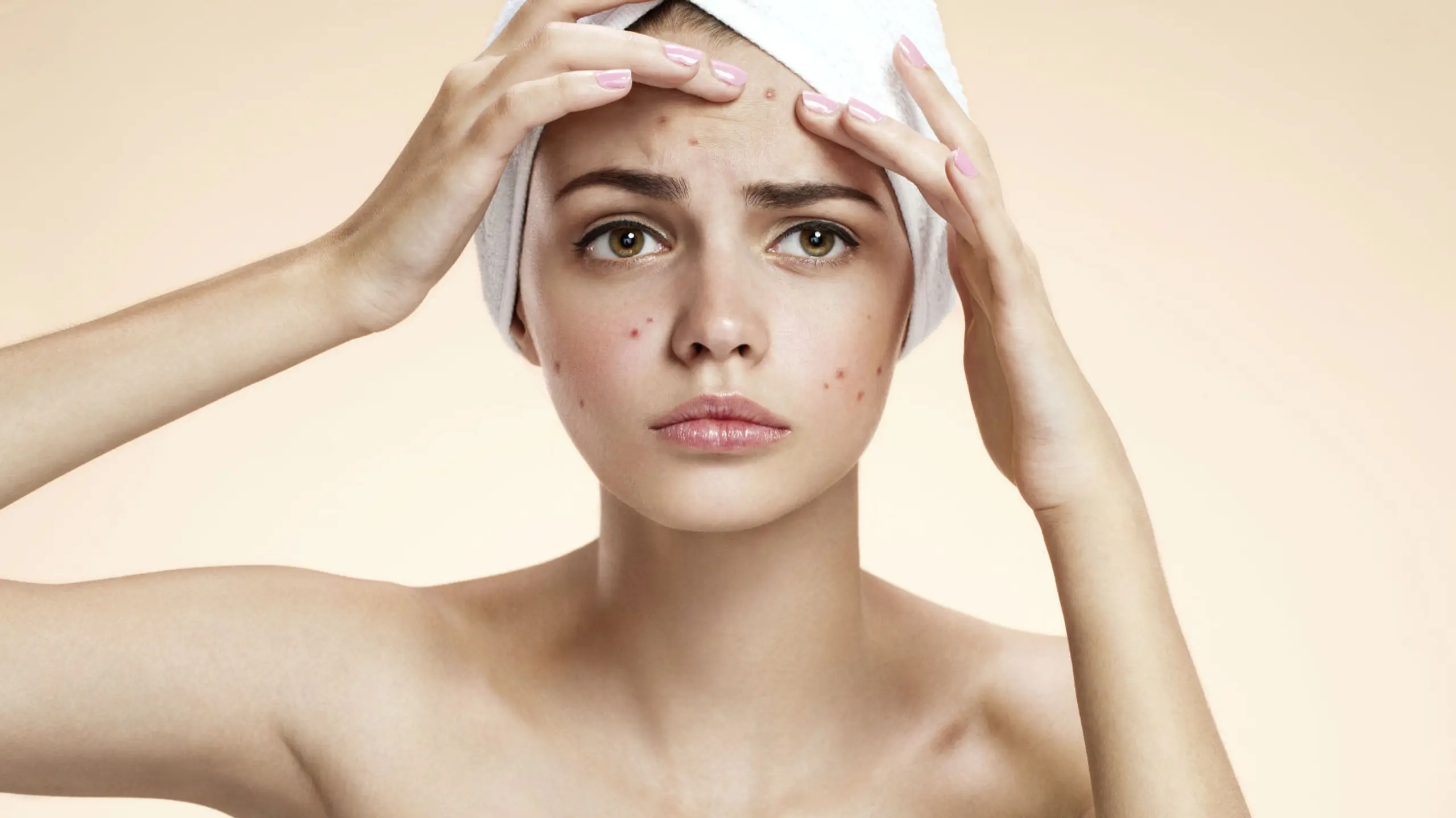 Diese Maske zum Selbermachen entfernt ALLE Mitesser