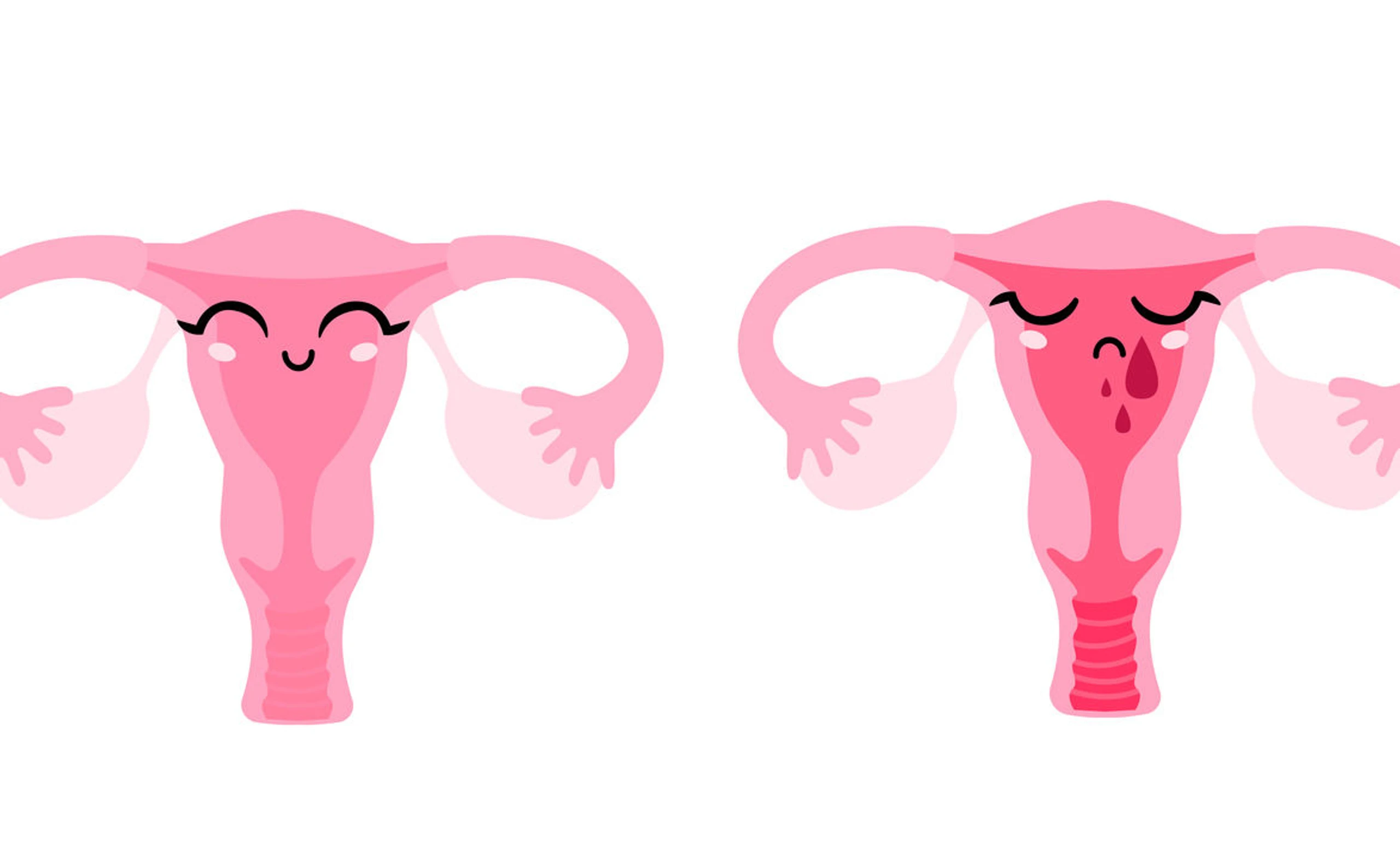 Menstruation: 6 Gründe, warum deine Periode zu früh kommt