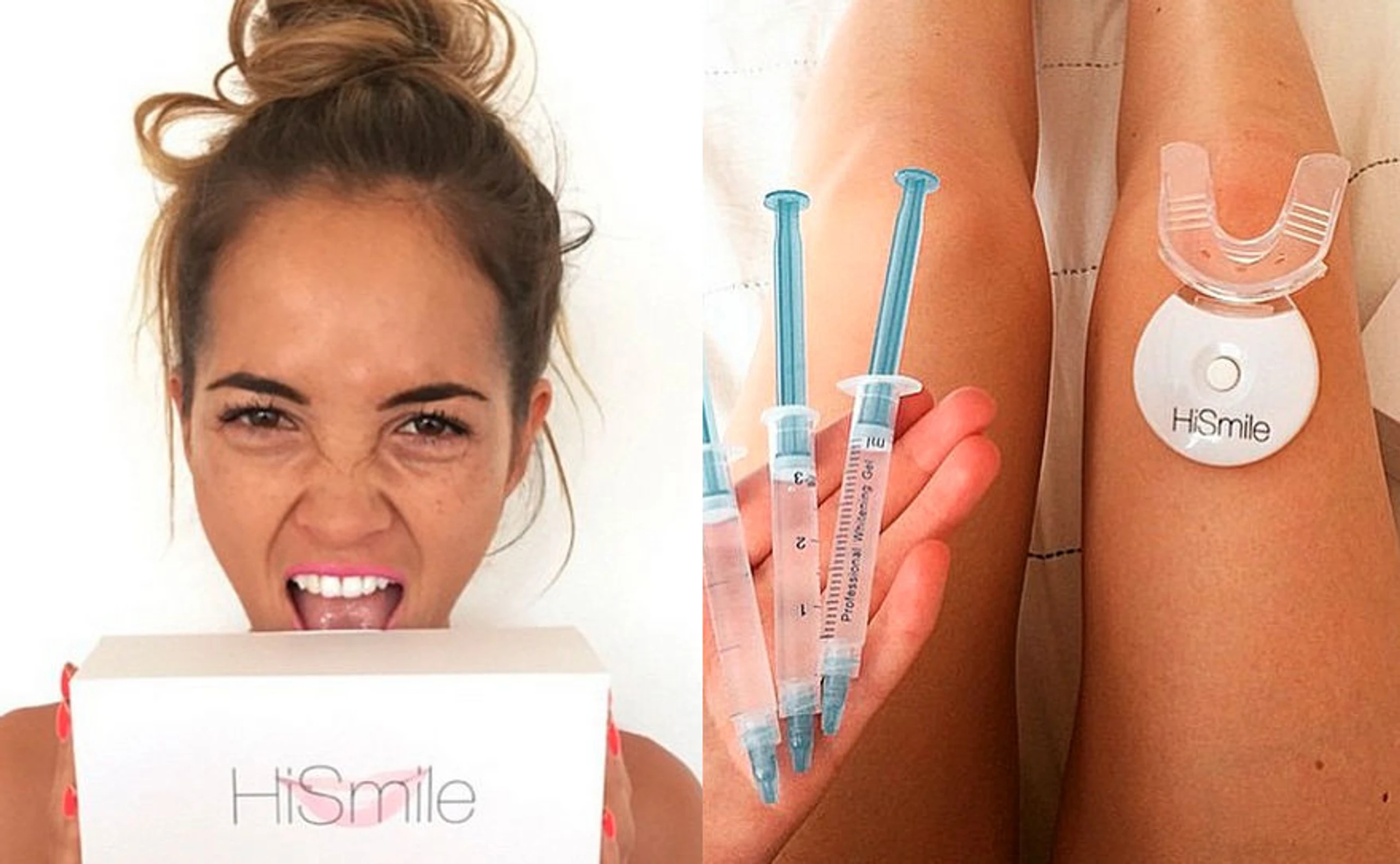 Im Test: HiSmileTeeth Bleaching
