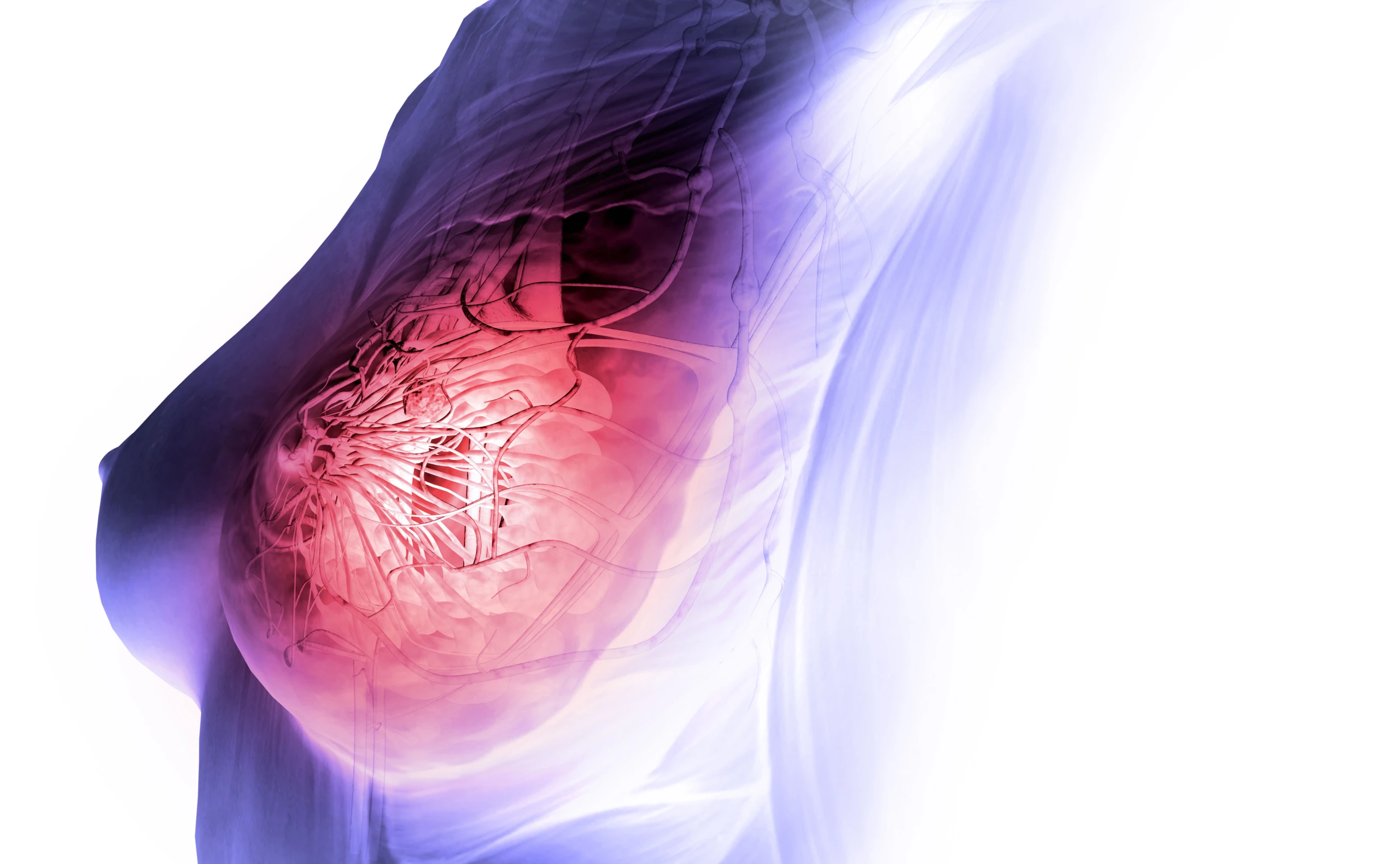 Brustkrebs, die häufigste Krebserkrankung der Frau, entsteht in der Brustdrüse.