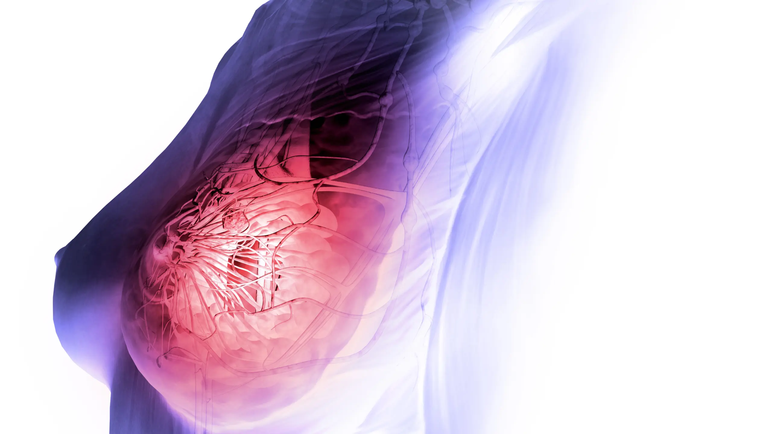 Brustkrebs, die häufigste Krebserkrankung der Frau, entsteht in der Brustdrüse.