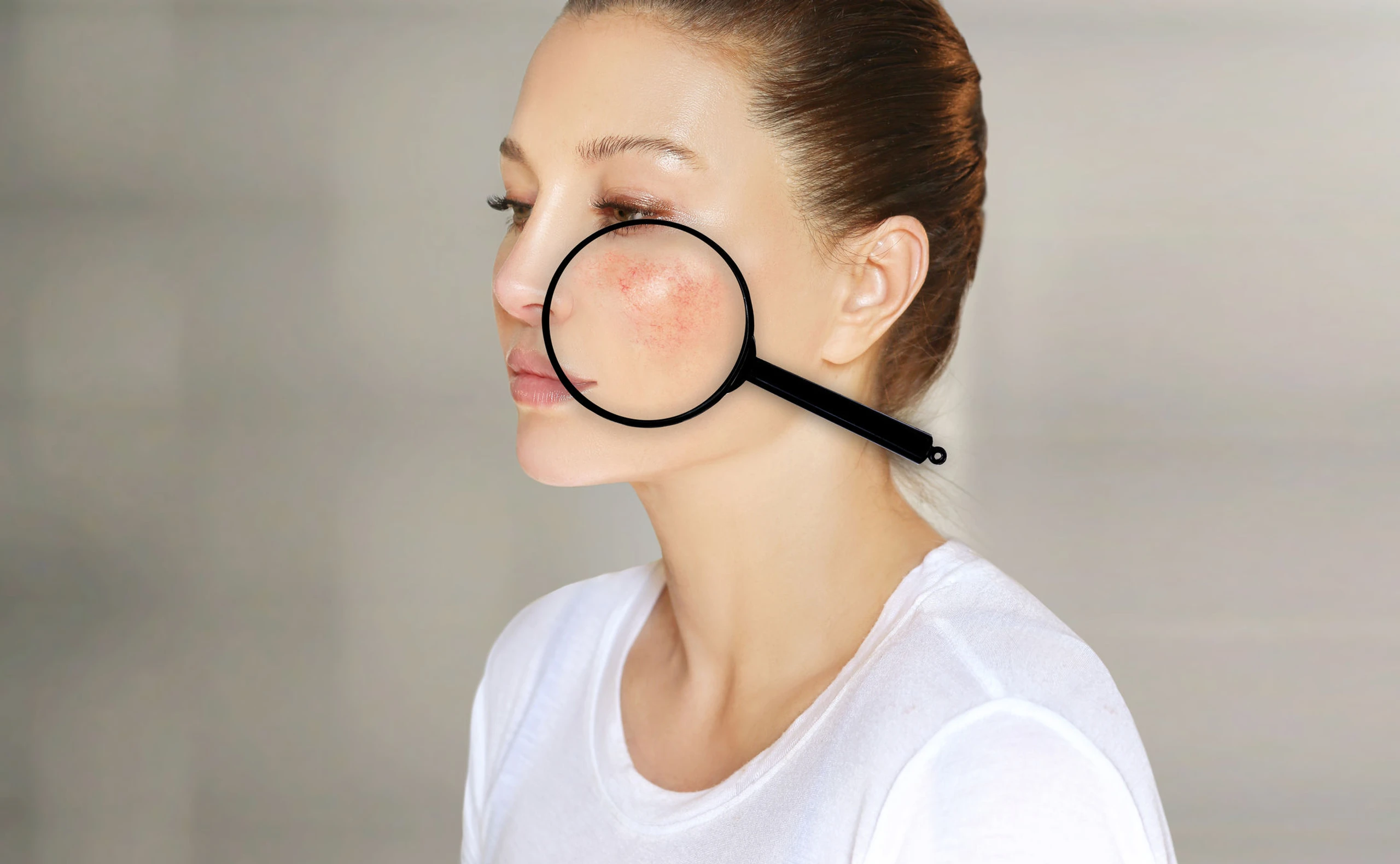 Akne, Rosacea, Neurodermitis &amp; Co: Alles, was du über Hautkrankheiten wissen solltest