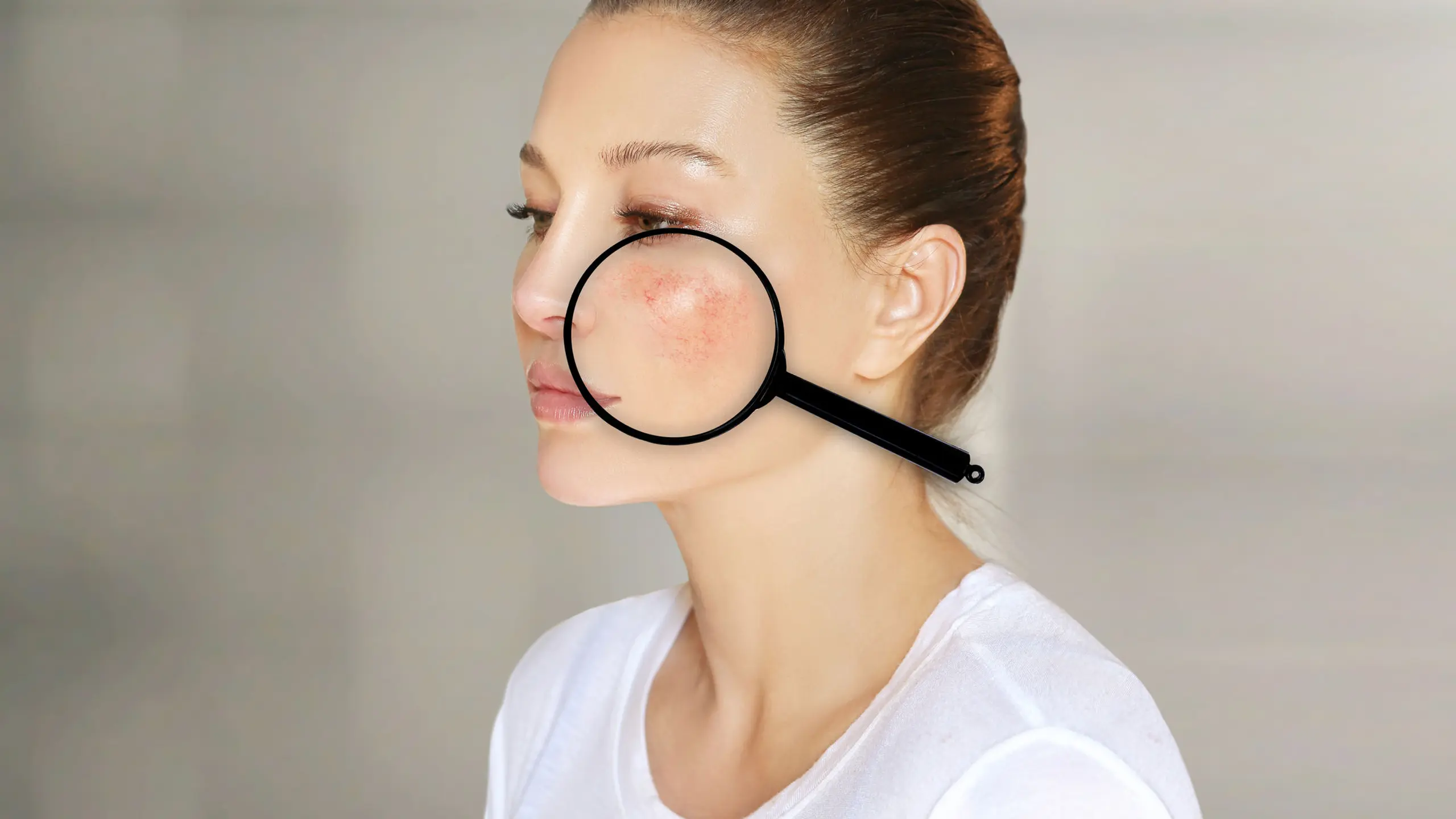 Akne, Rosacea, Neurodermitis & Co: Alles, was du über Hautkrankheiten wissen solltest