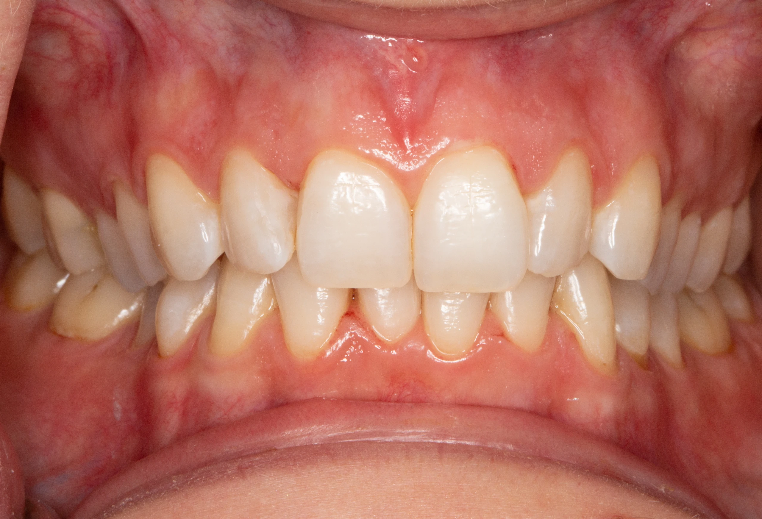 Blurred image background