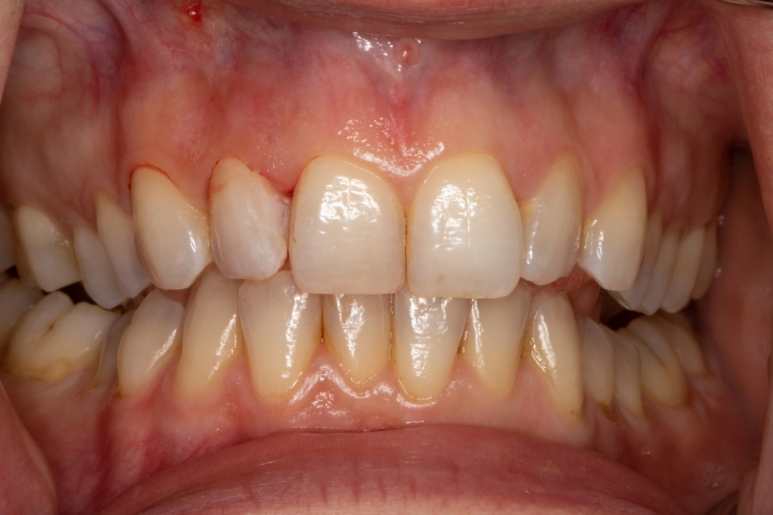 Blurred image background