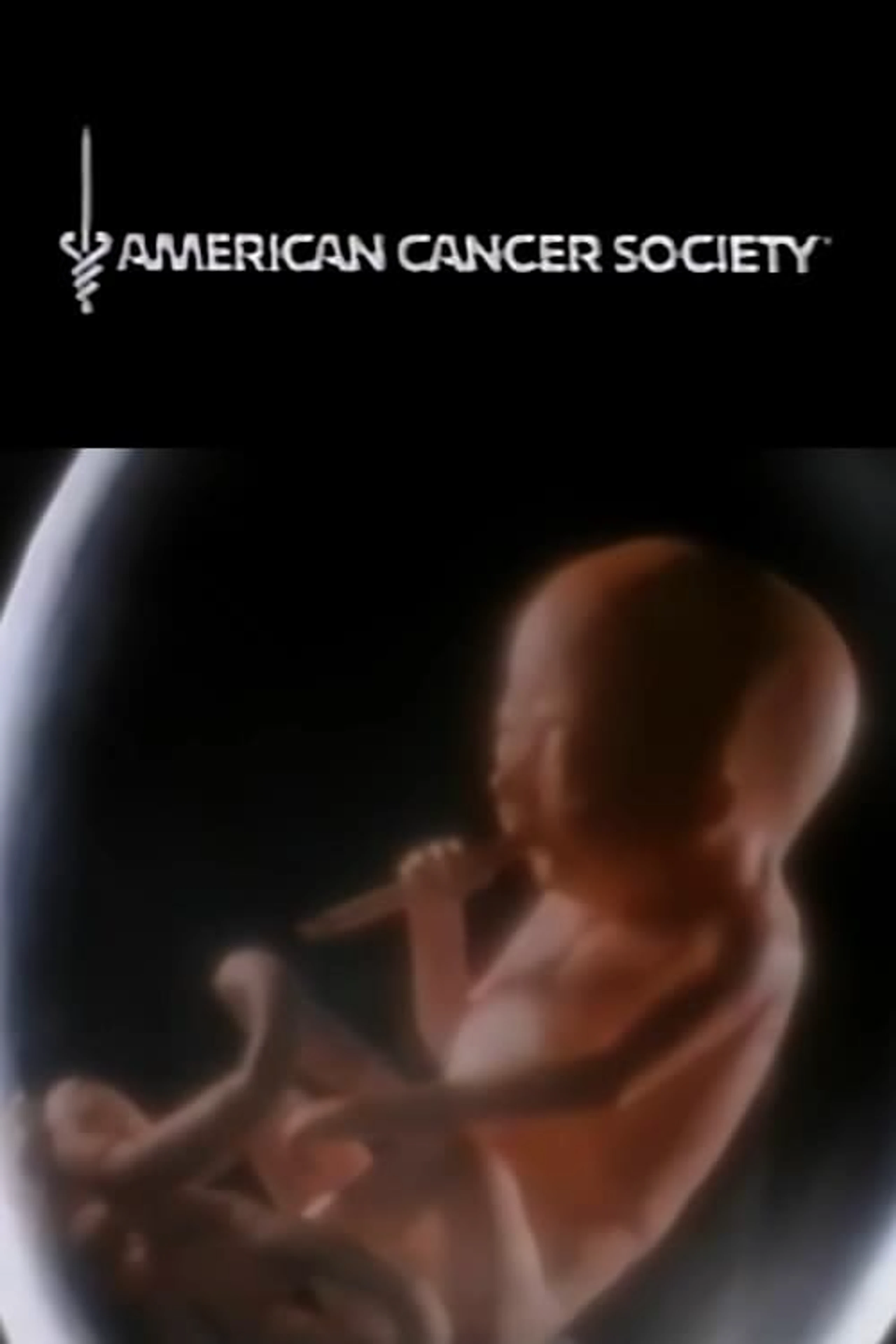 The American Cancer Society: Smoking Fetus