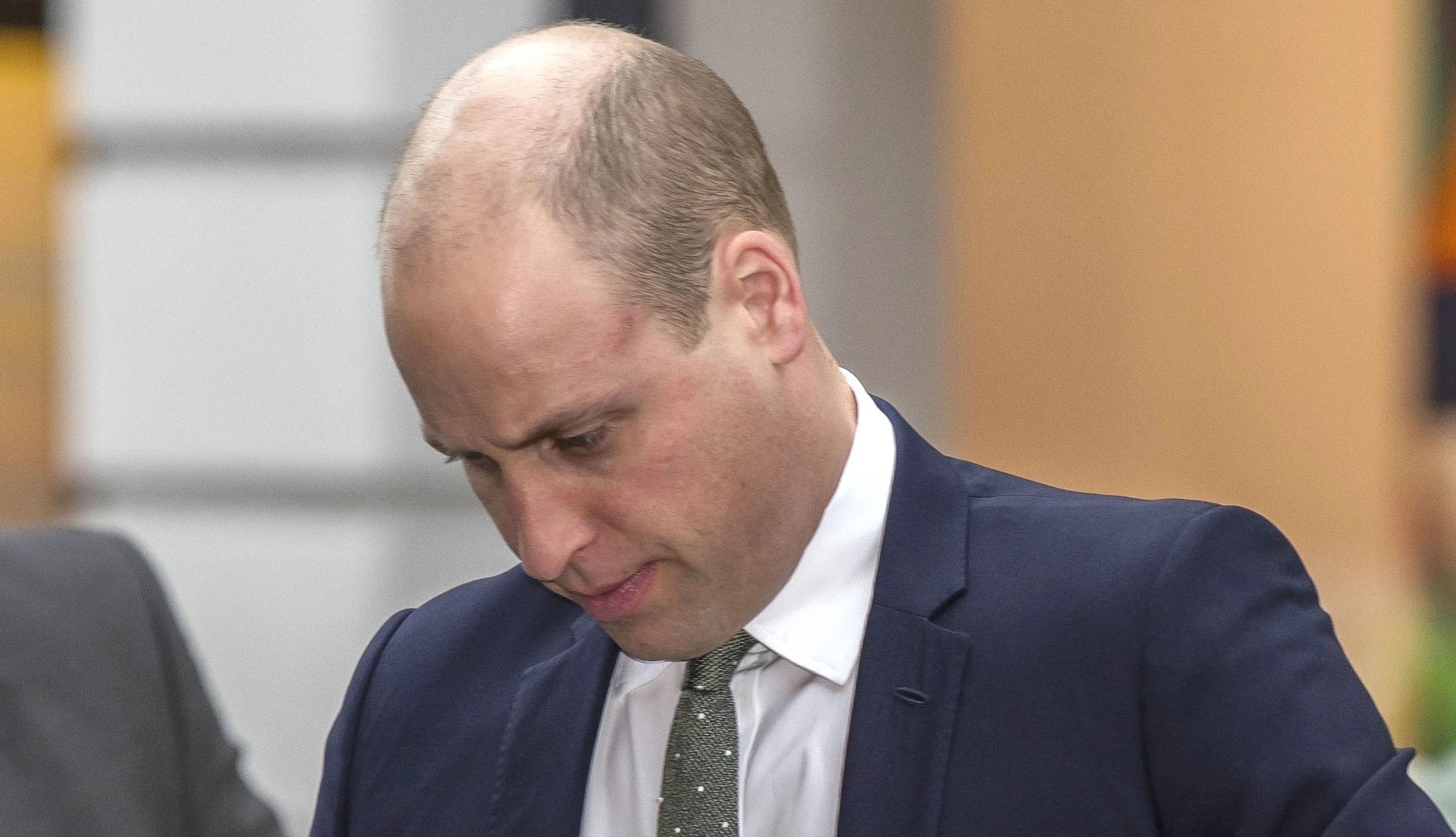 Haarige Sache - Prinz William hat das Problem vieler Männer: die Haare werden weniger