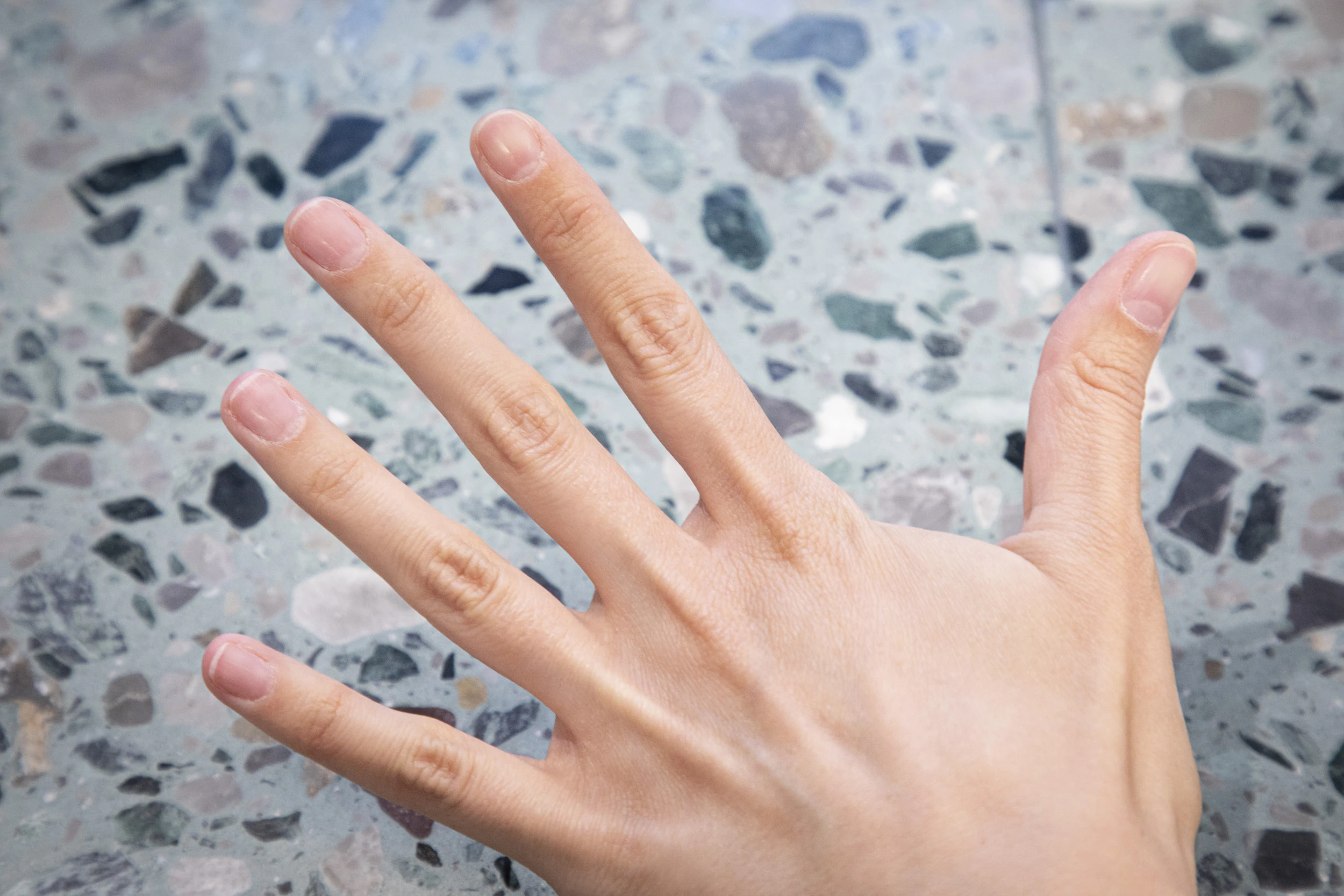 nagelmond