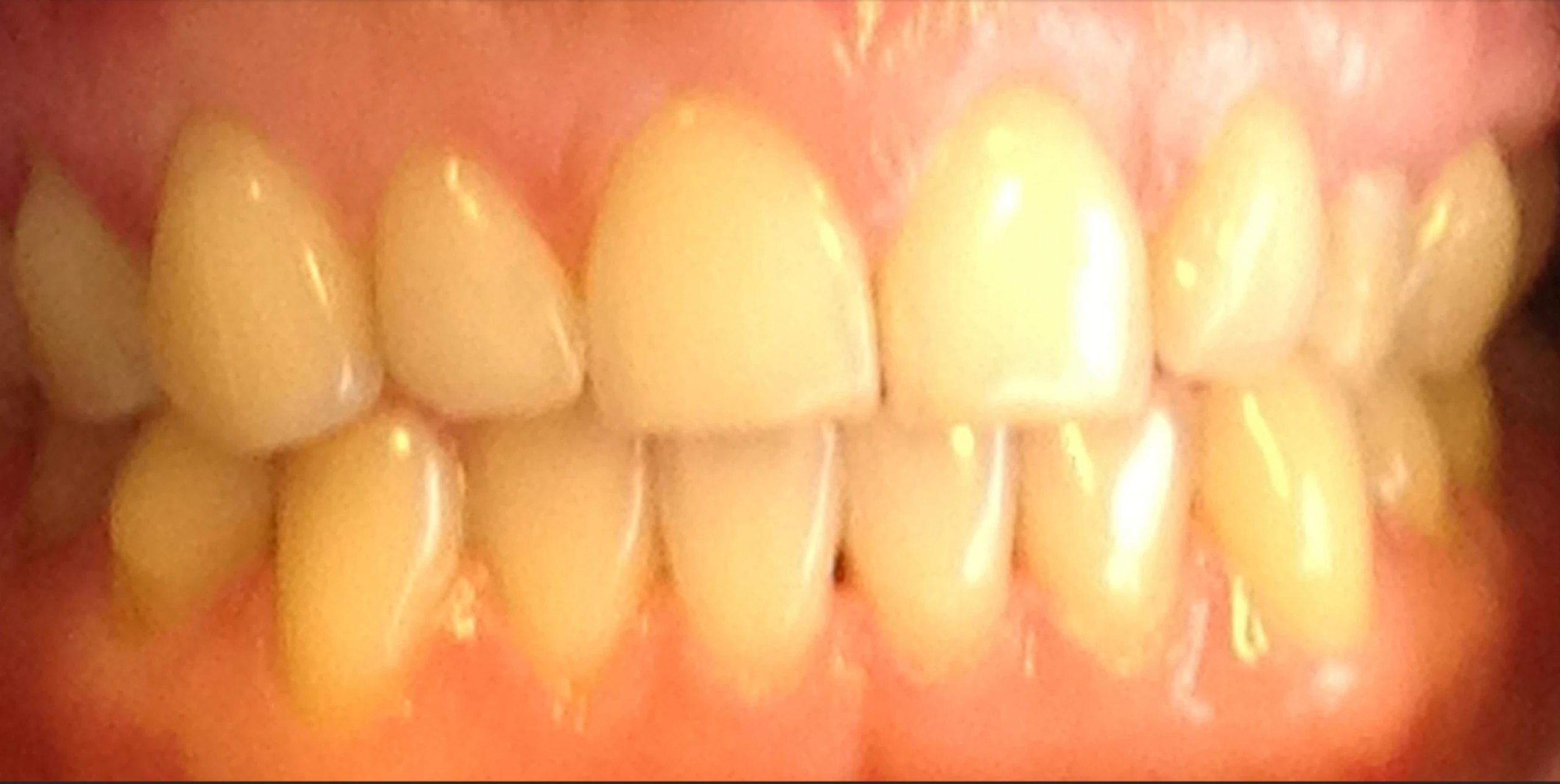 Blurred image background