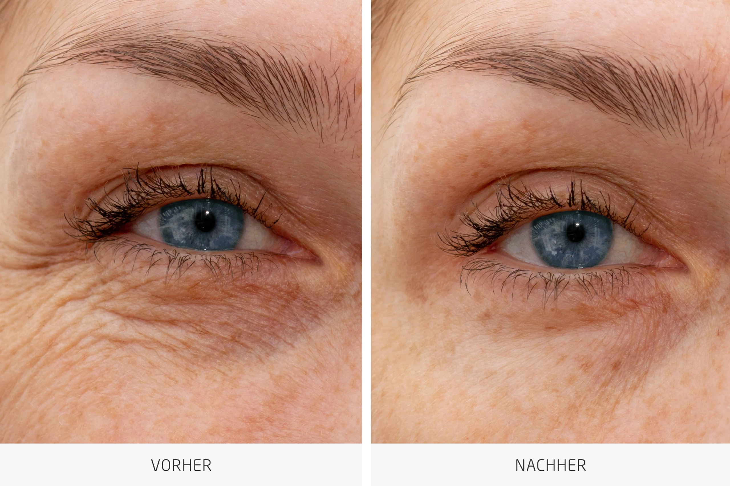 Blurred image background