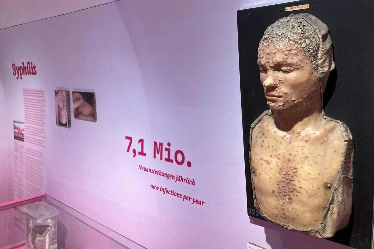 Das Naturhistorische Museum klärt über Geschlechtskrankheiten auf