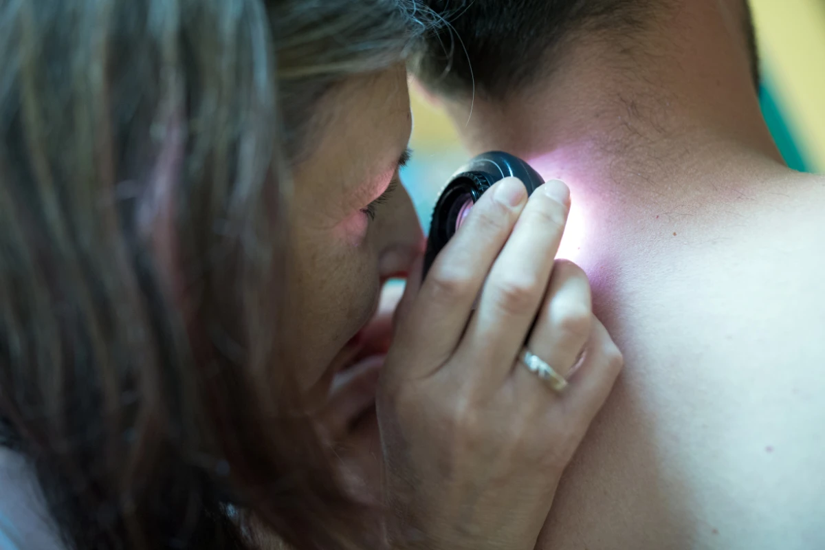 Bis zu 3 Mio. Fälle von NMSC werden pro Jahr weltweit gemeldet