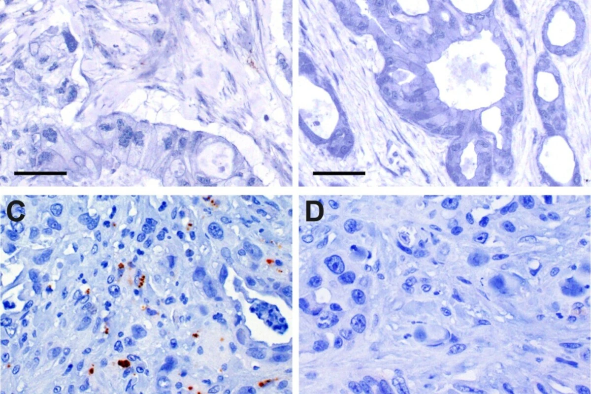 Immunhistochemischer Nachweis bakterieller Zellwandbestandteile