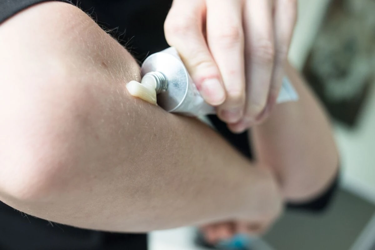 Fünf Schmerzsalben schneiden sehr gut ab - drei setzen auf Ibuprofen