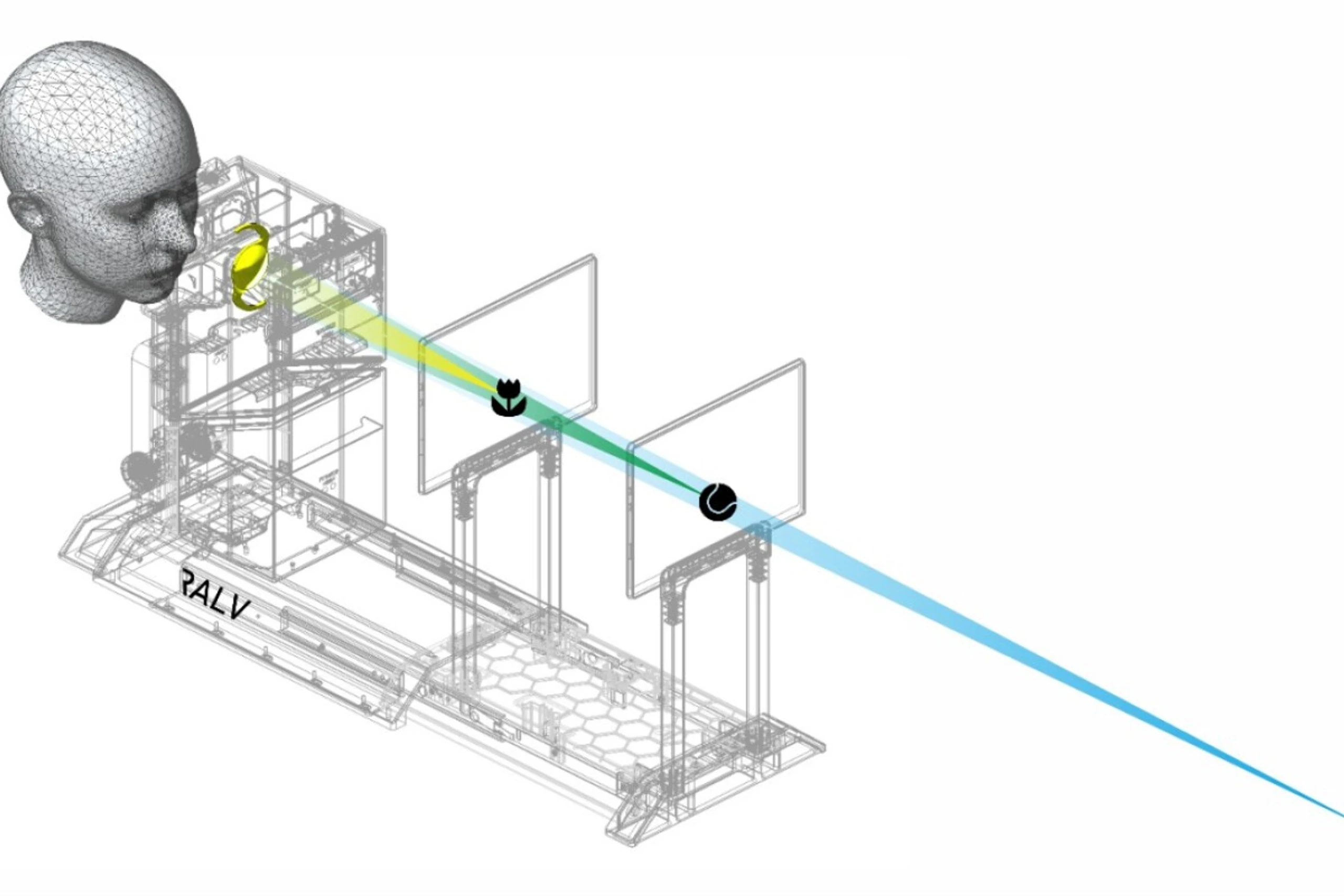 Vereinfachter schematischer Aufbau von RALV mit Intraokularlinse (IOL) in gelb