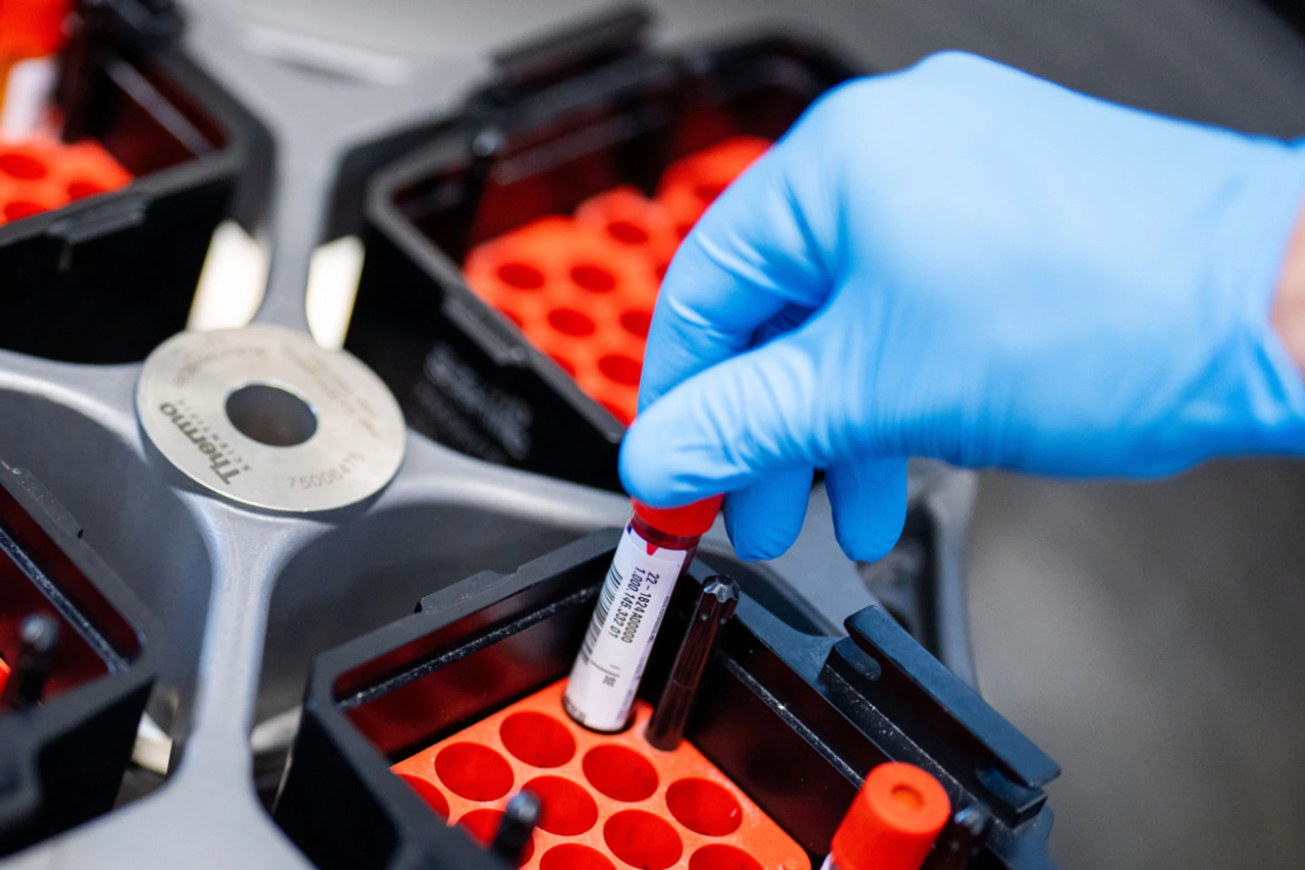 PTX-3-Spiegel bei Betroffenen zehn Wochen nach Infektion stark erhöht