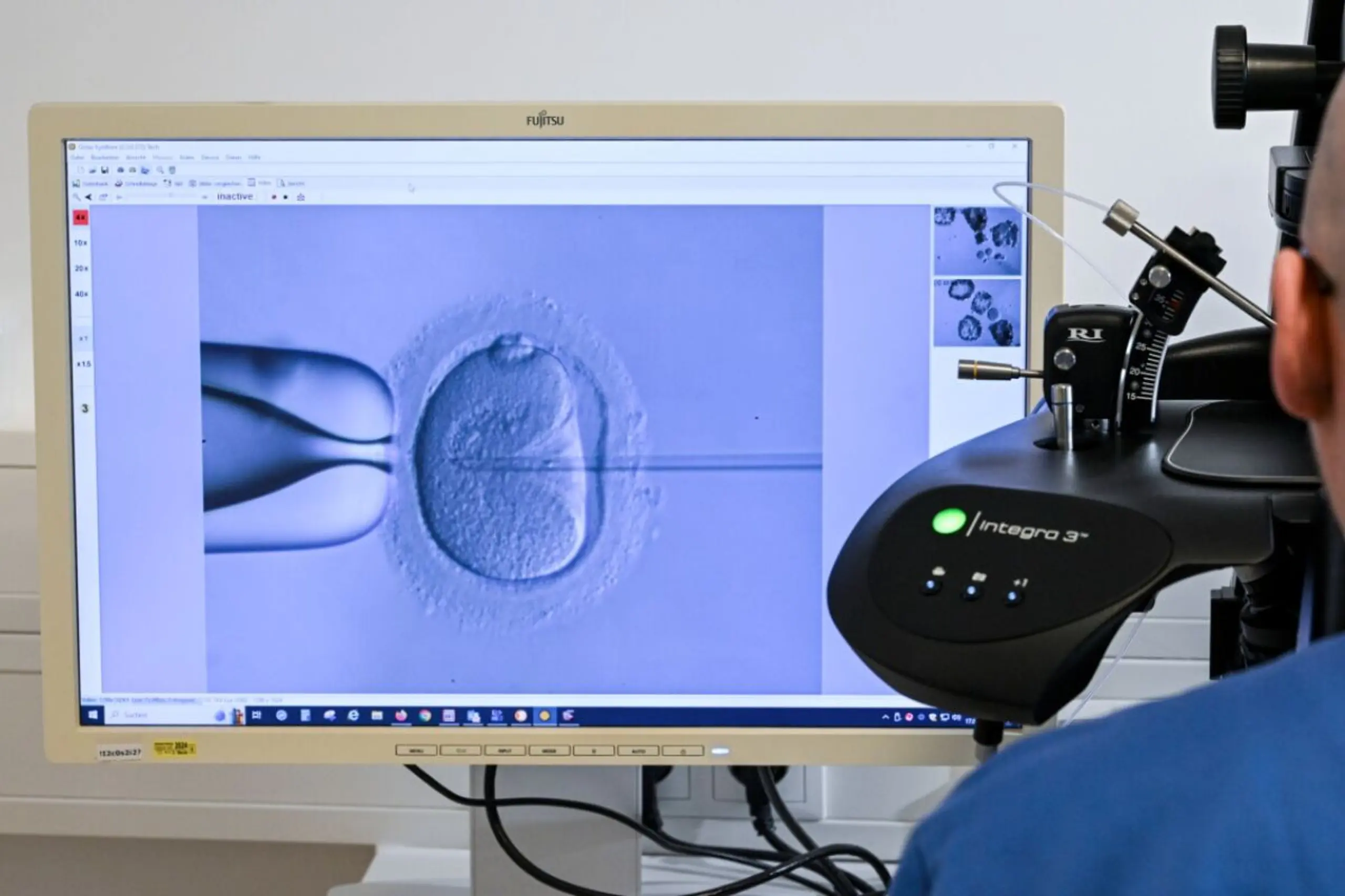 Von Forschenden auch mit Spermien befruchtet