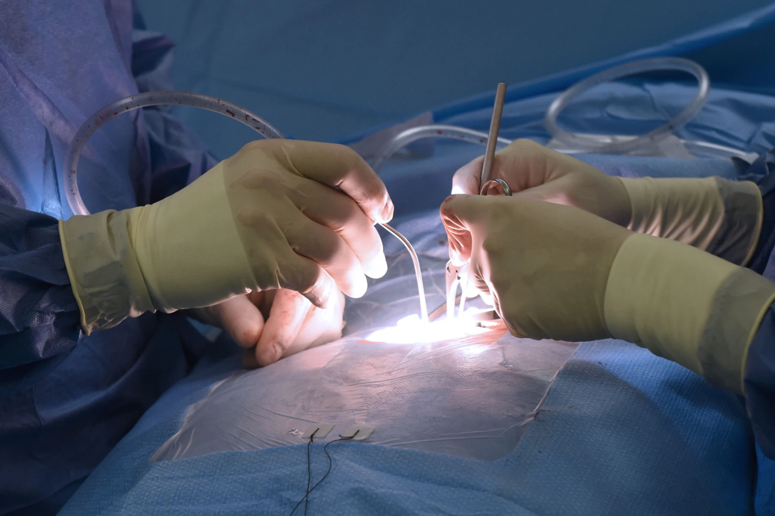 Schönheitschirurgen warnen vor riskanten Eingriffen