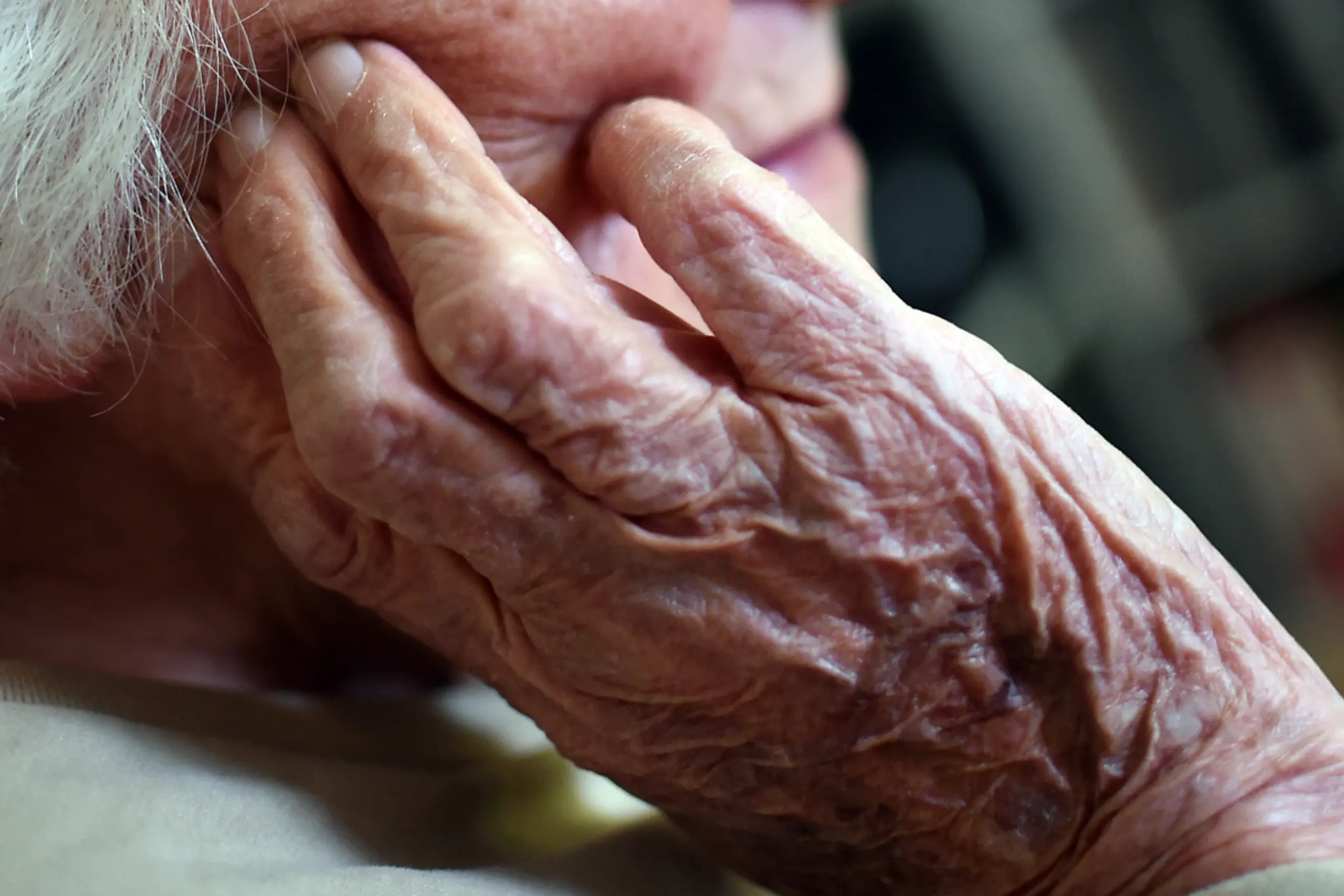 Im Jahr 2018 war Alzheimer als häufigste Form der Demenz