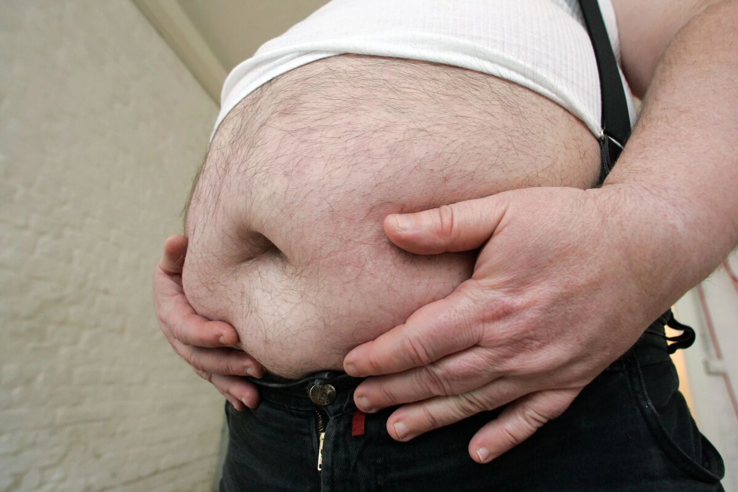 Adipositas Hauptrisikofaktor für nächtliche Atemaussetzer