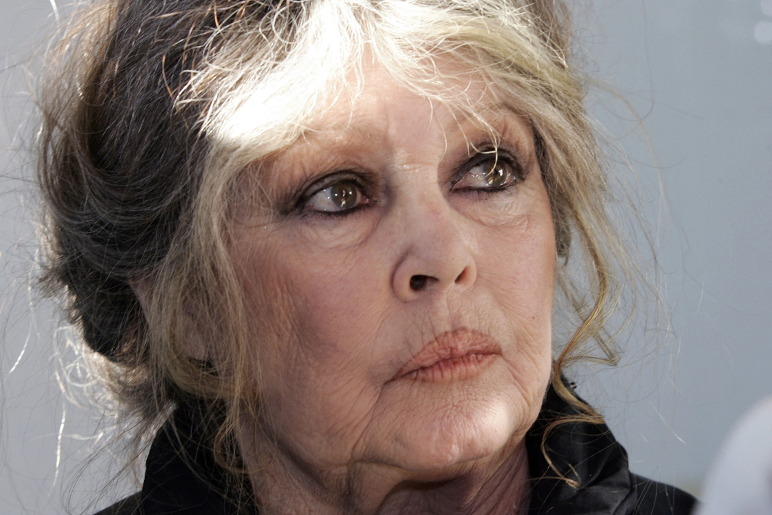 91-jährige Filmikone Brigitte Bardot wurde operiert