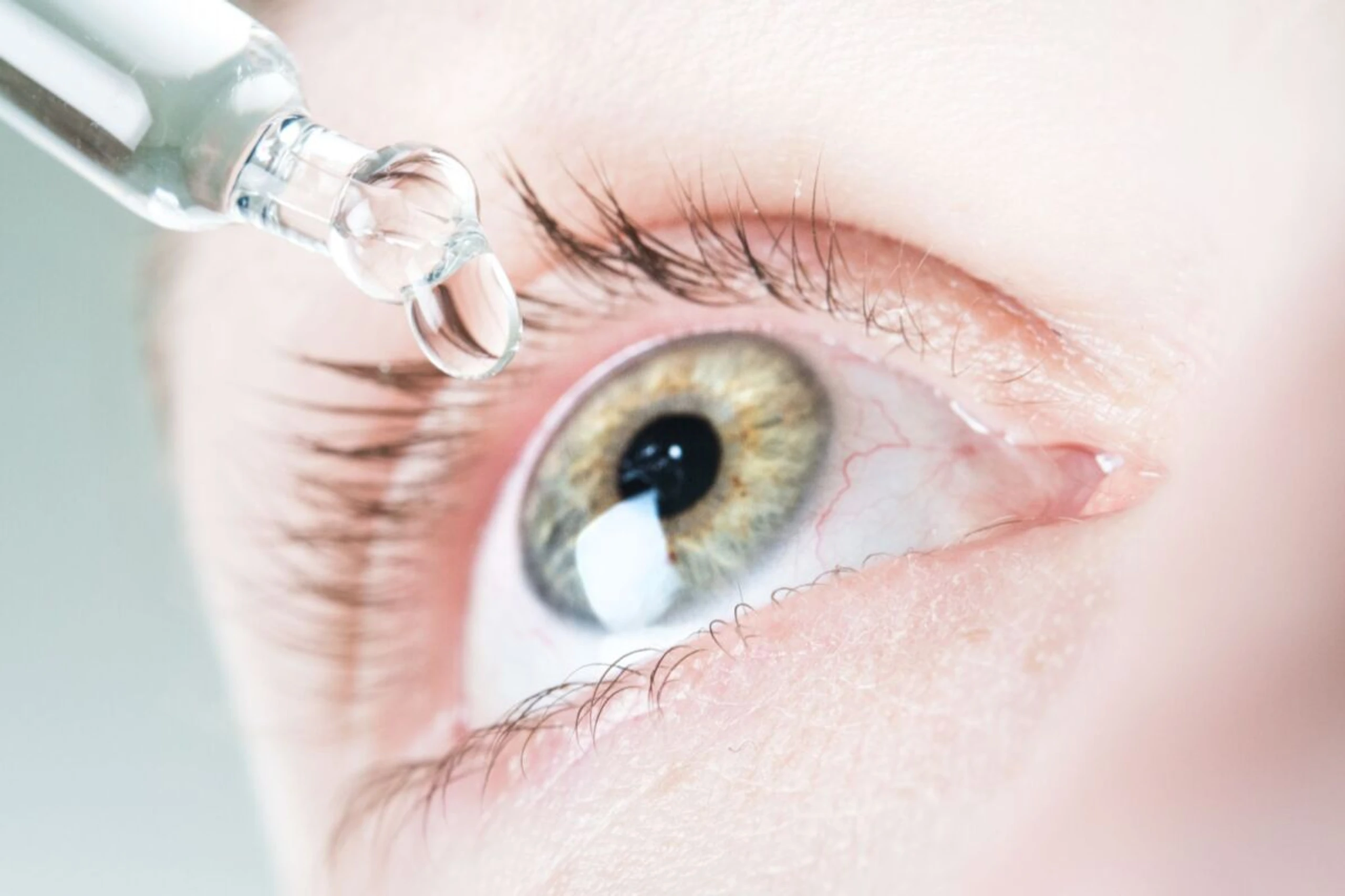 Bei Bildschirmarbeit hilft es Blinzelpausen einzulegen