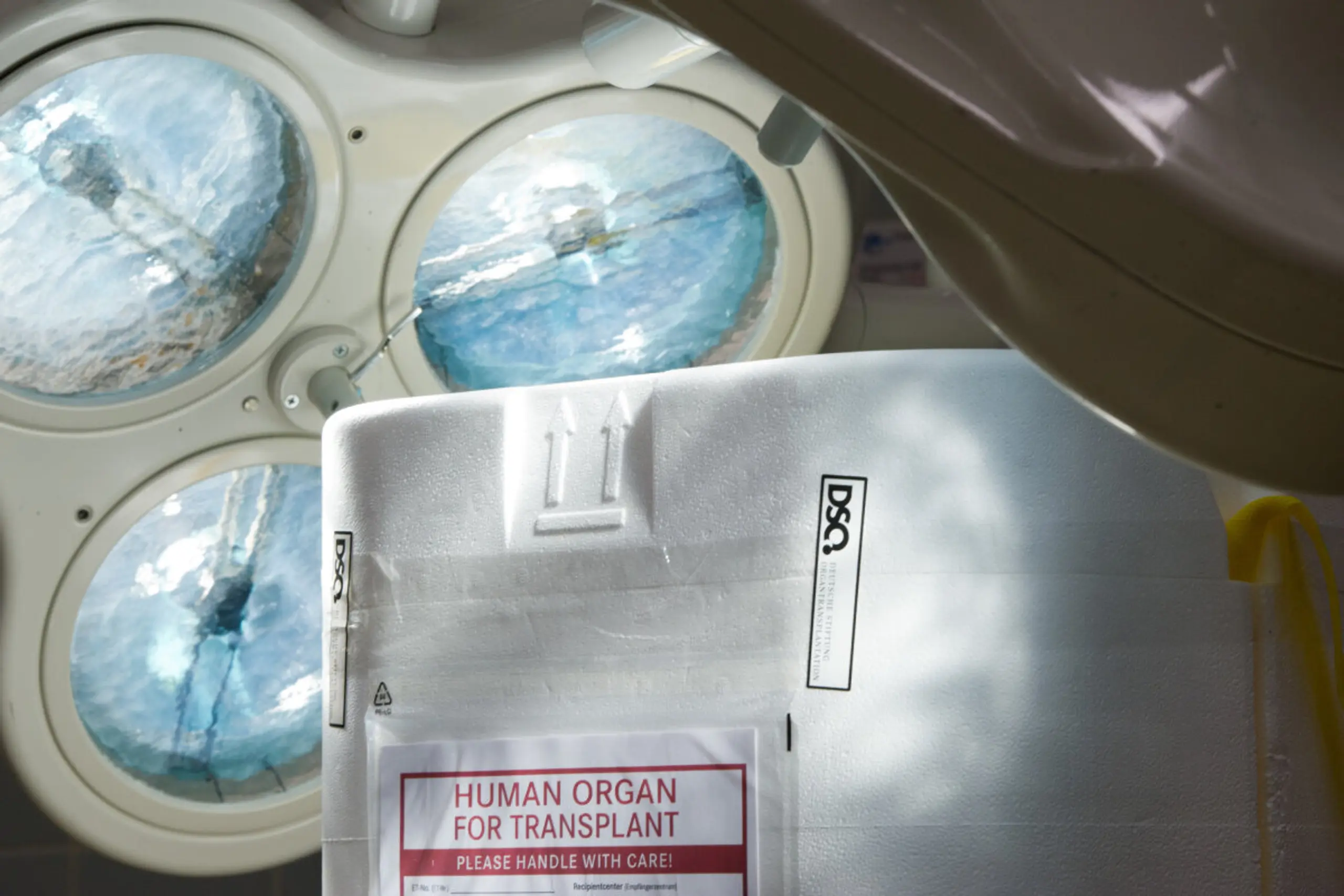 Nach Einführung der Opt-out-Lösung sanken Lebendspenden um 29 Prozent