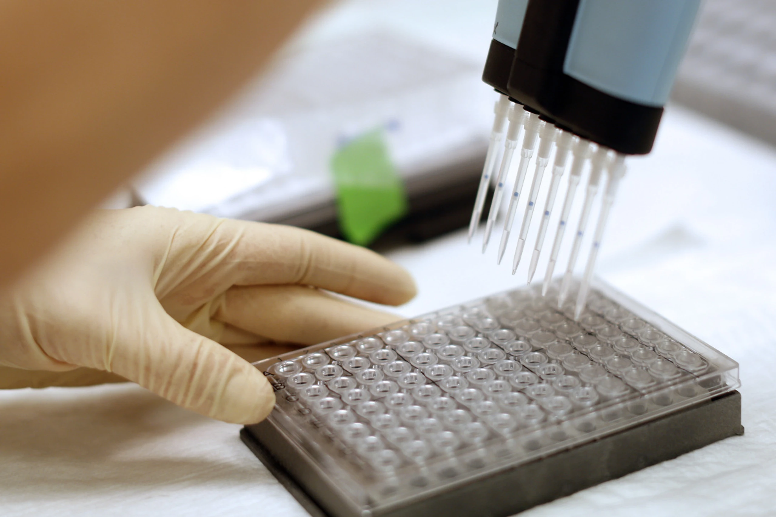 Eine klinische Studie ist derzeit im Laufen