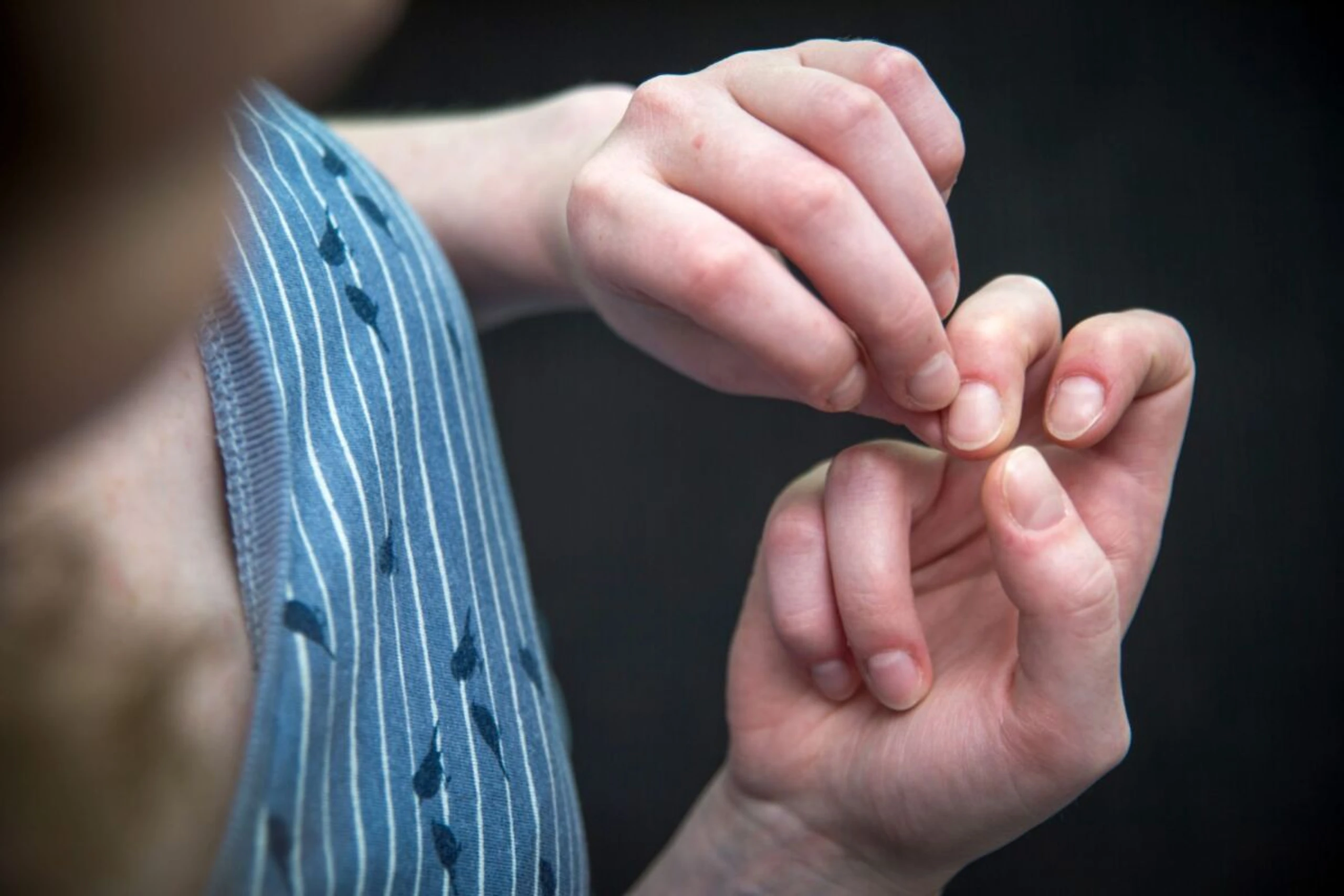 Körperfokussierte repetitive Verhaltensweisen sind weit verbreitet