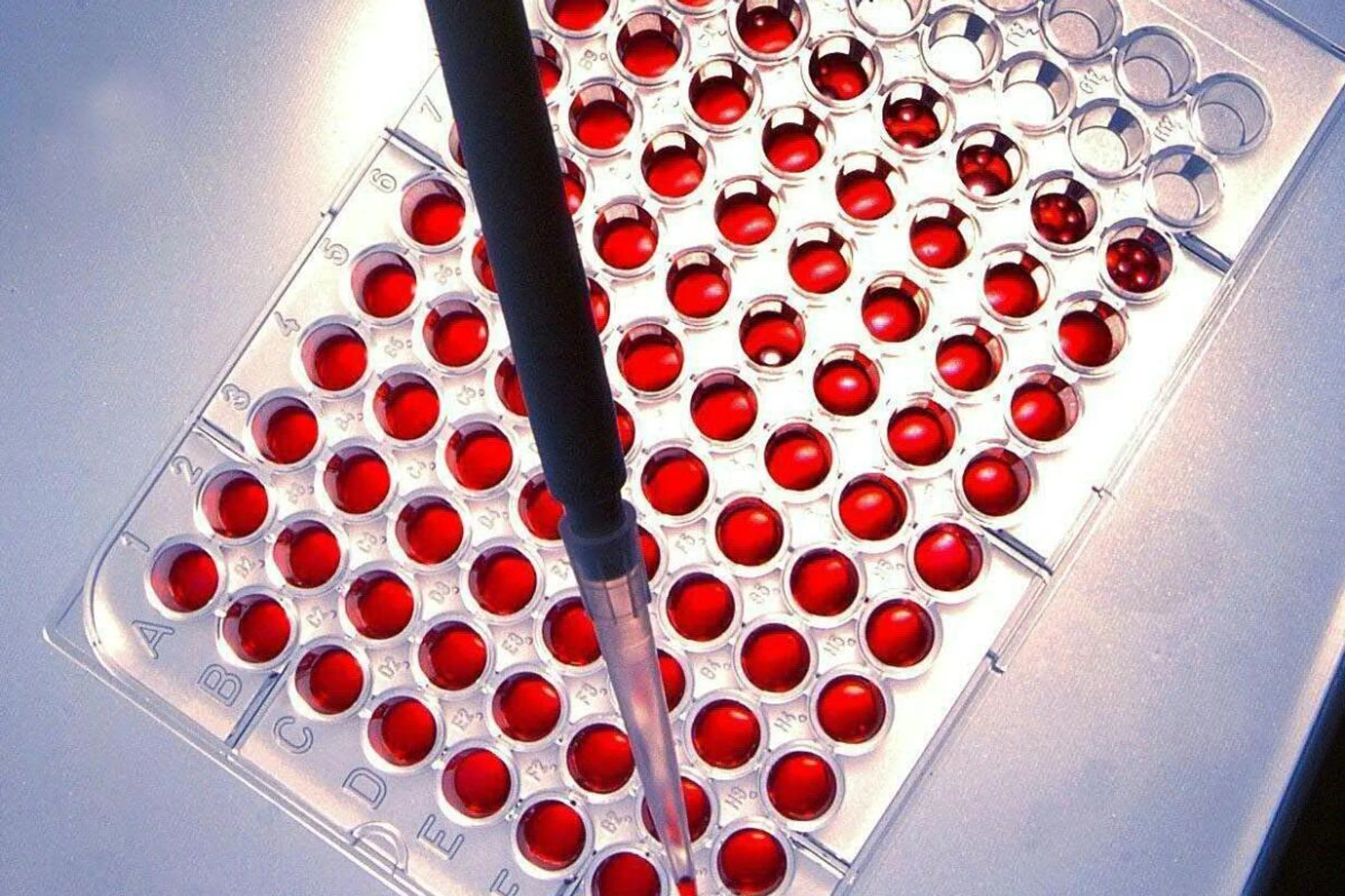 In Zellen ohne Spop wüten häufiger NUP98-Chimären
