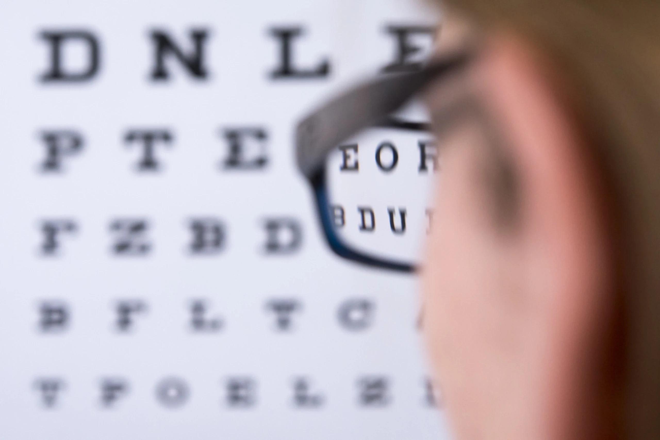 Der Startpunkt für Kurzsichtigkeit liegt zumeist in der Kindheit