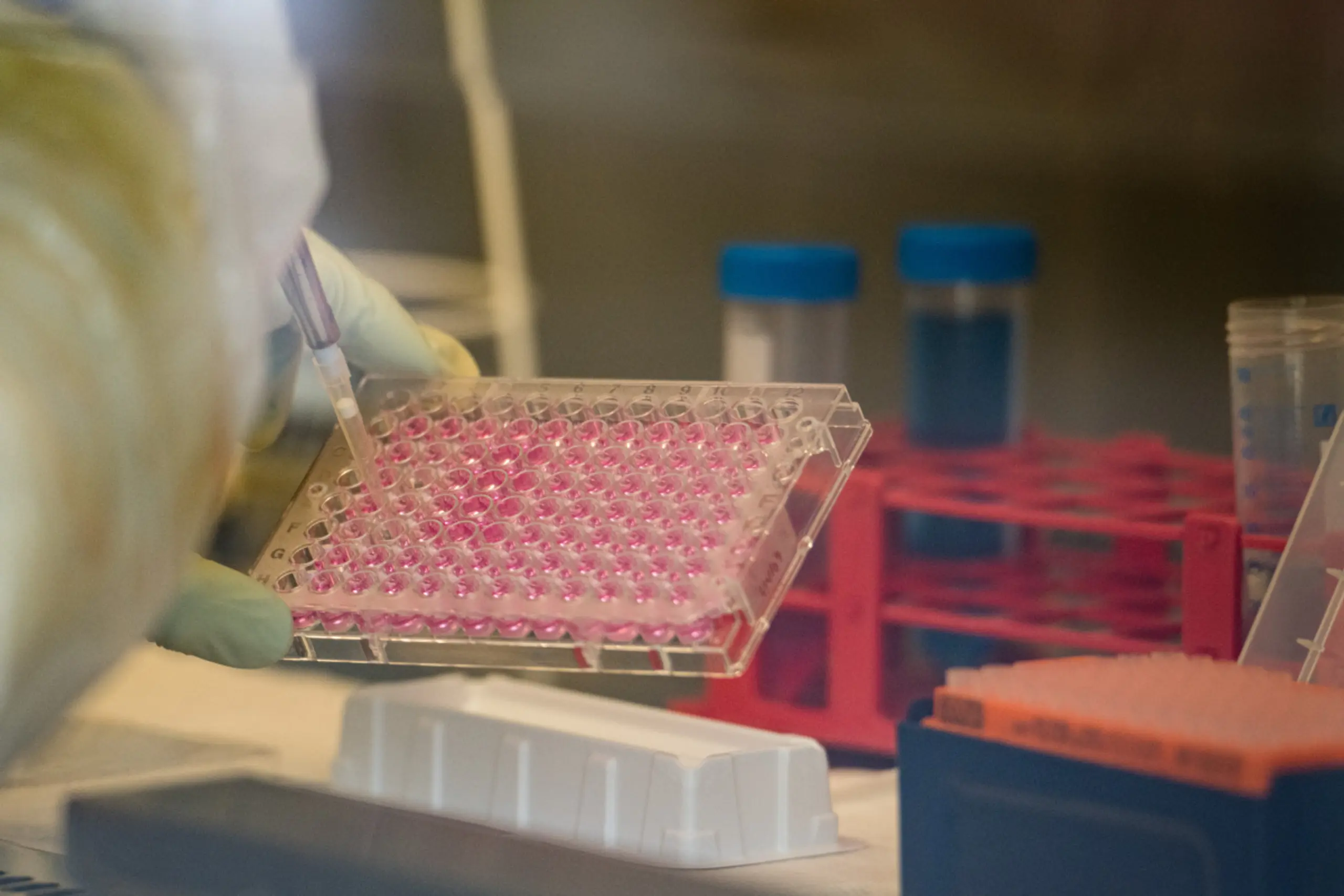 Kleinigkeiten können viel anders machen