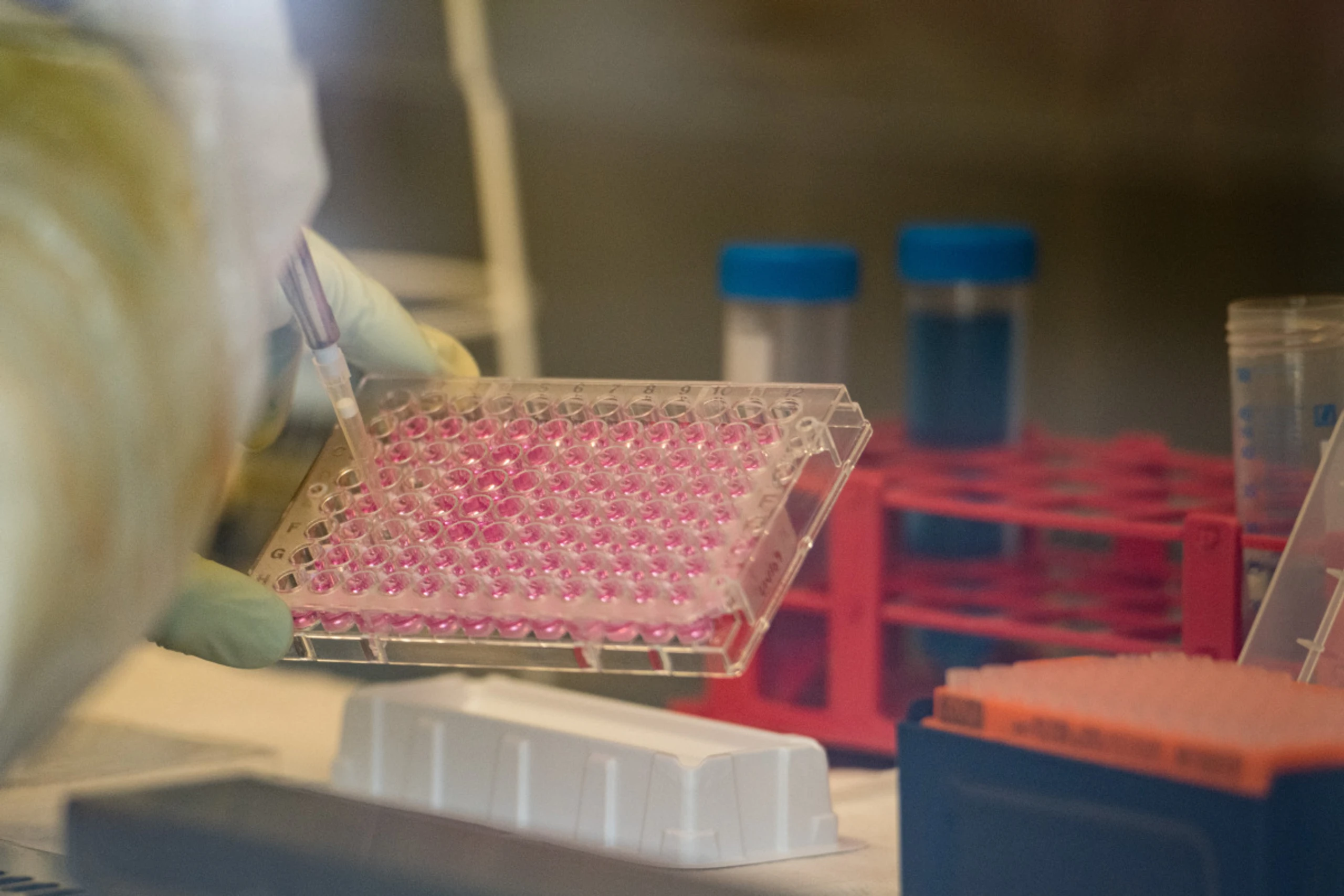 Kleinigkeiten können viel anders machen